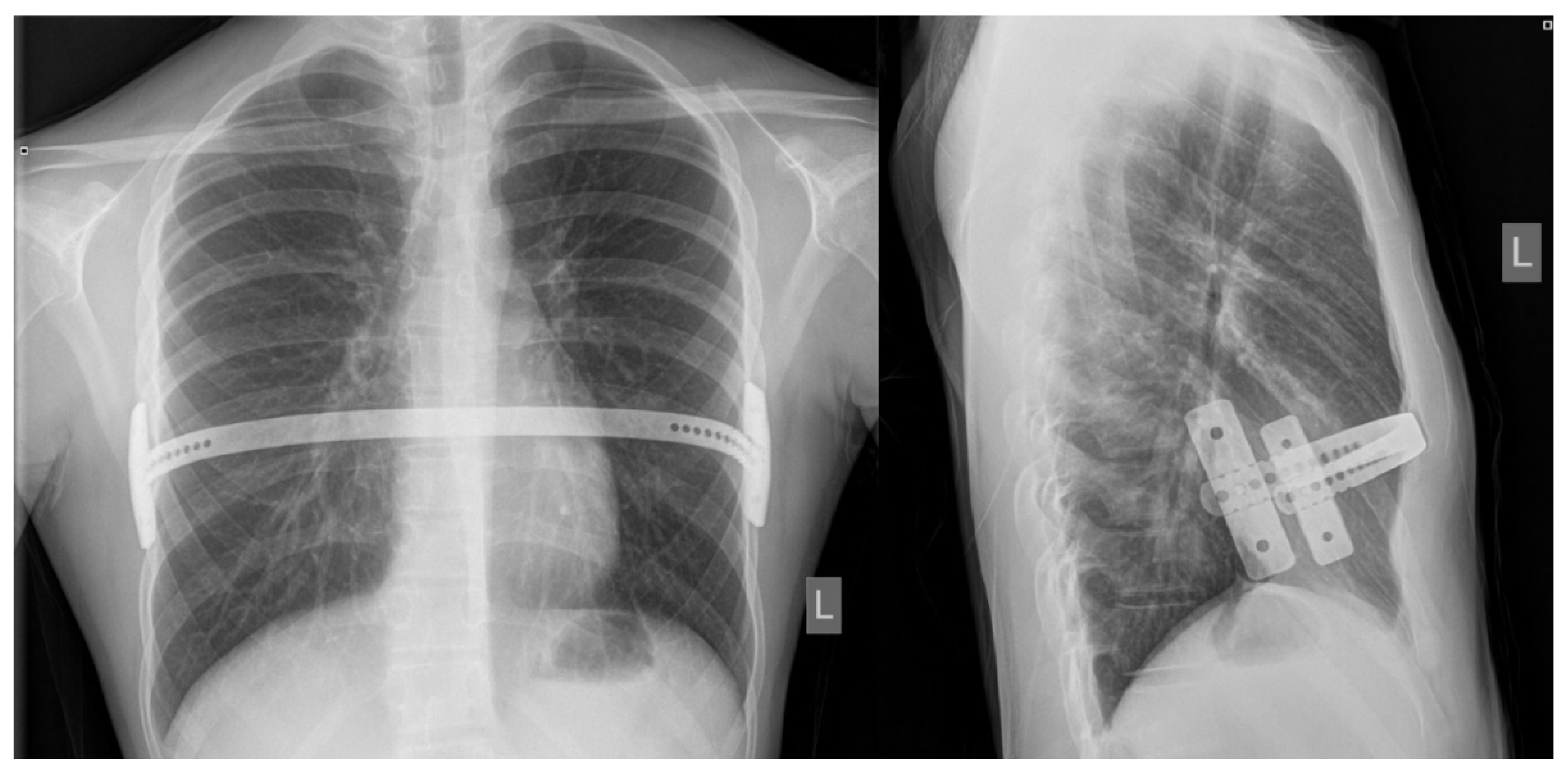 Children 08 01071 g003