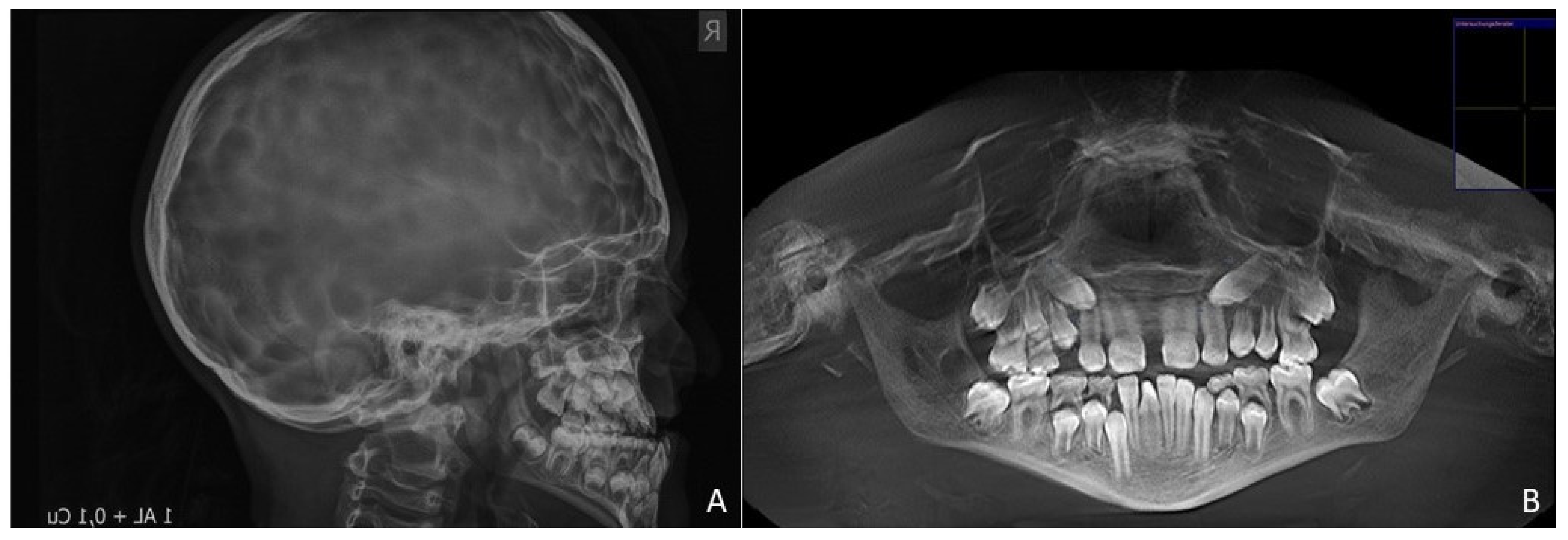 Children 08 01122 g002