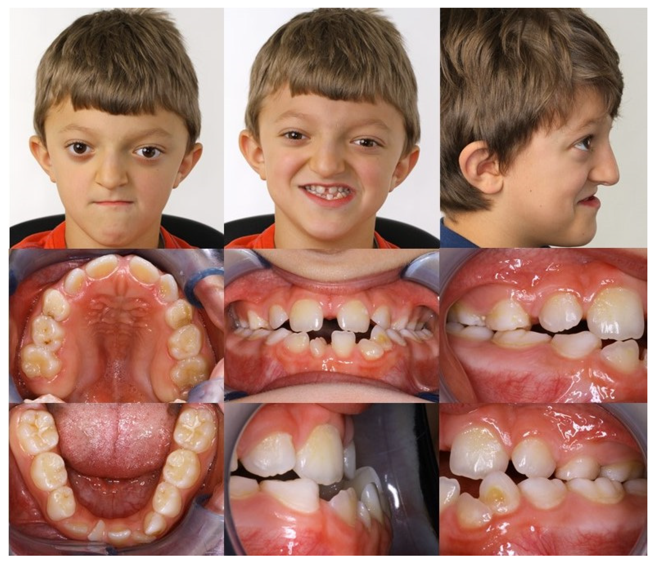 Children 08 01122 g003