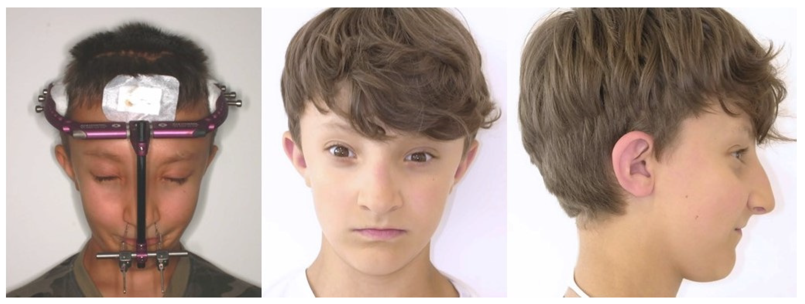 Children 08 01122 g004