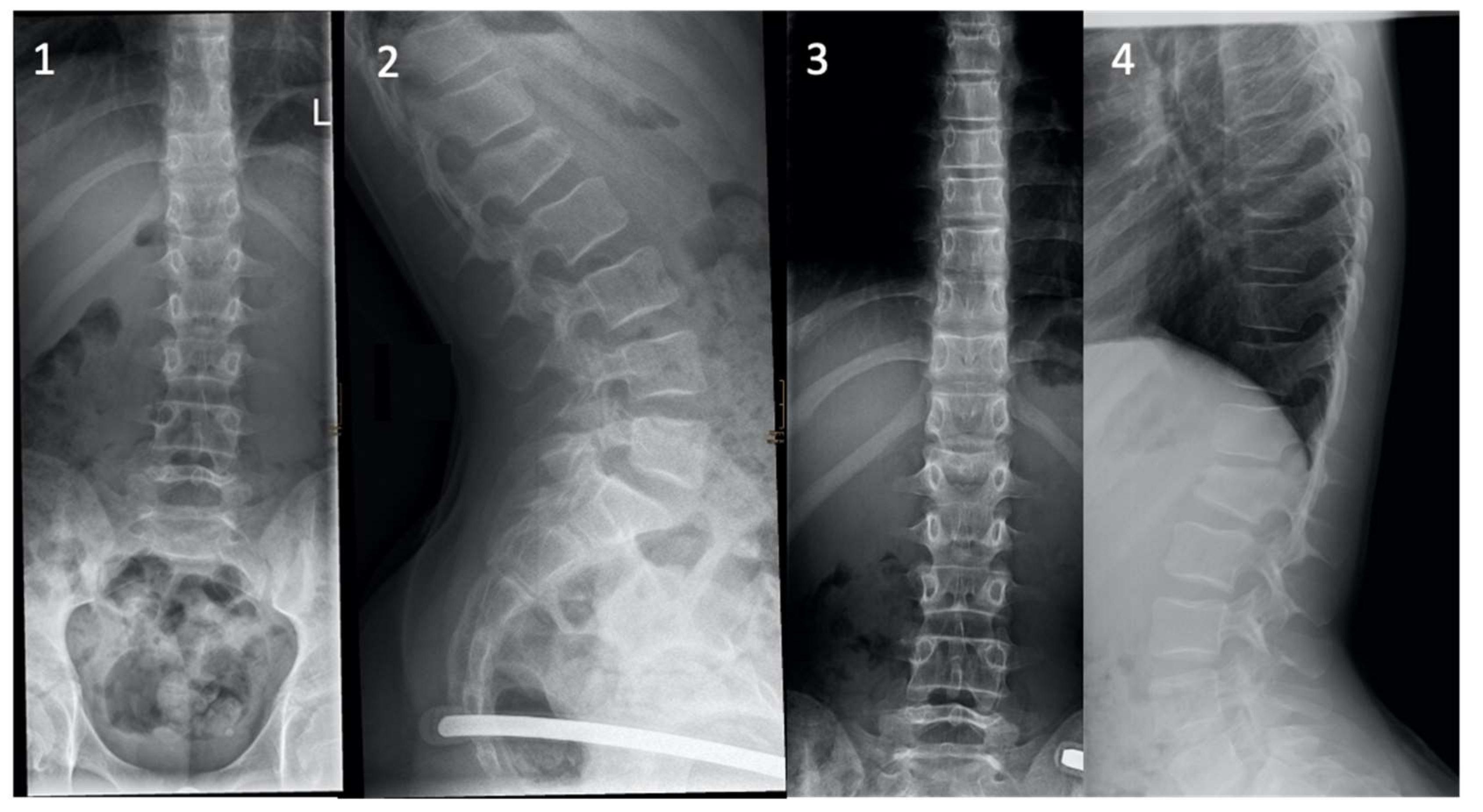 Children 08 01127 g004