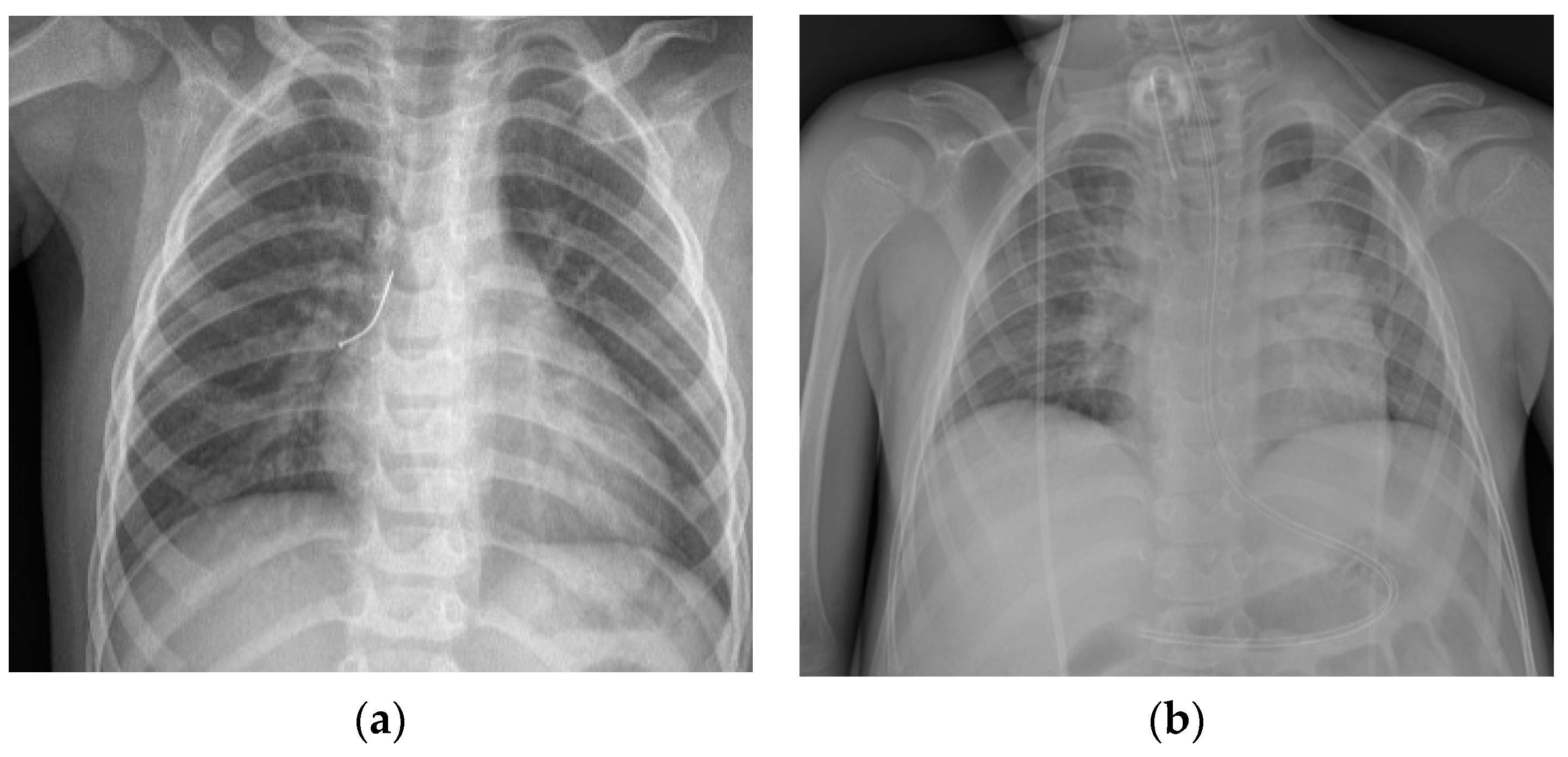 Children 08 01206 g003a