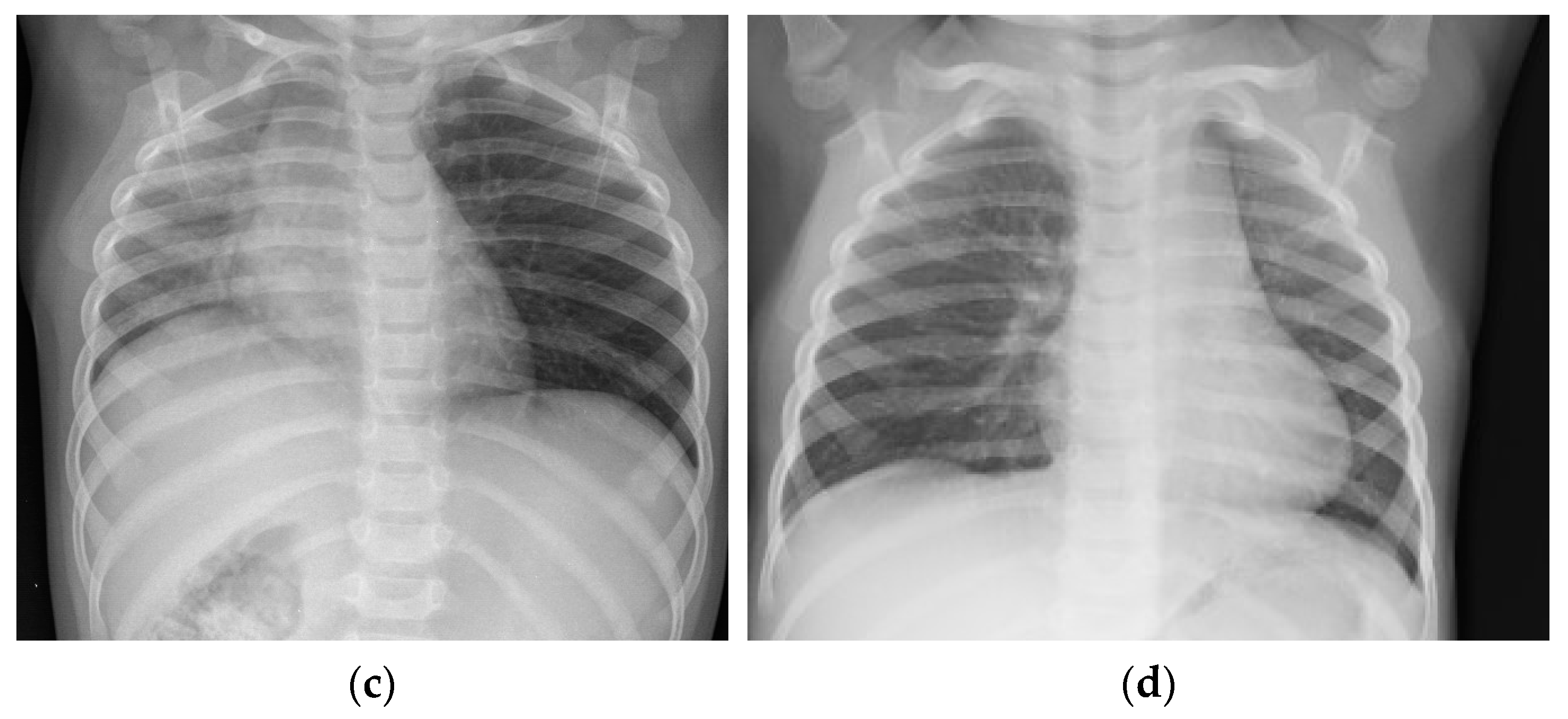 Children 08 01206 g003b