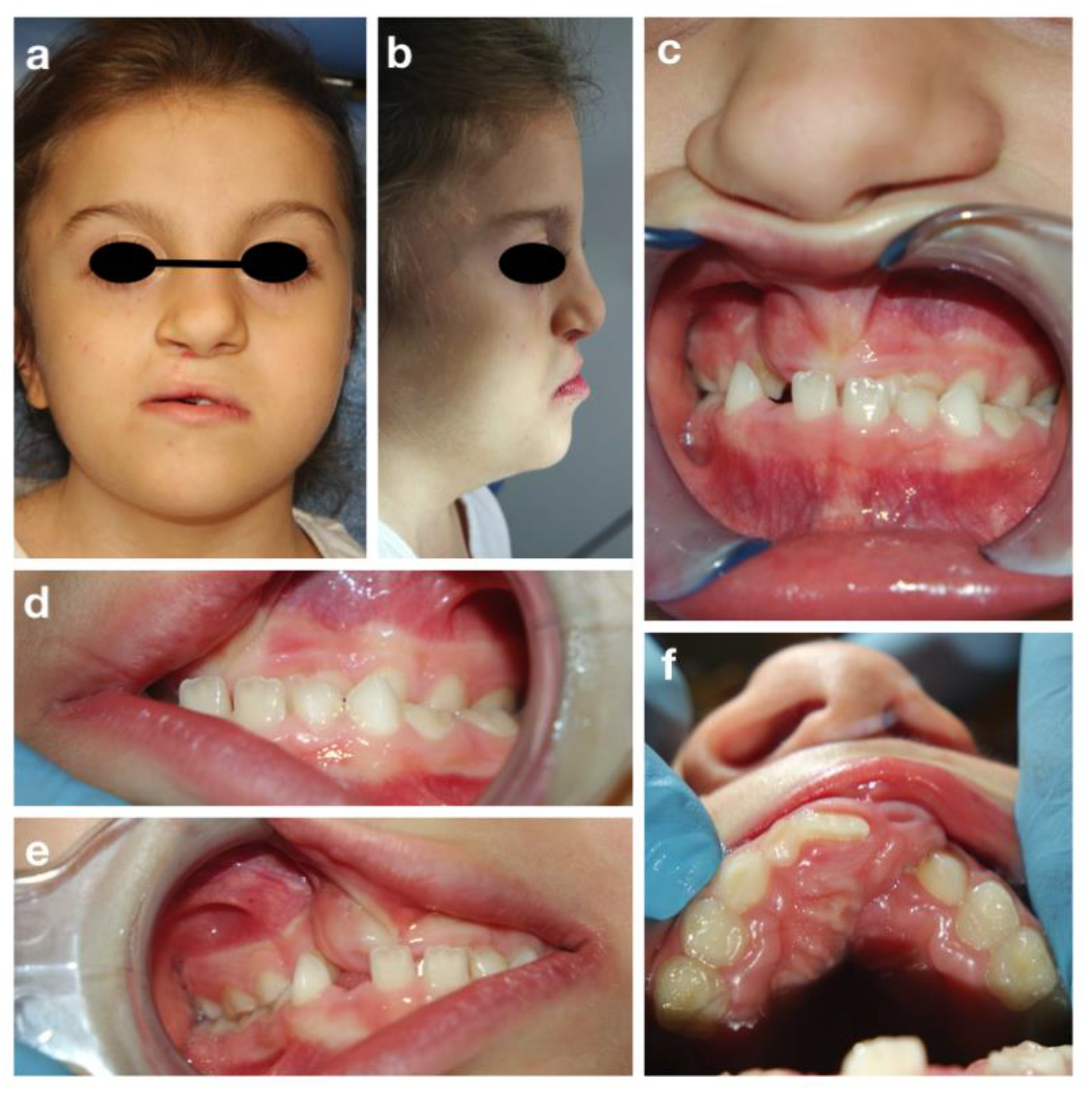 Children 09 00012 g004