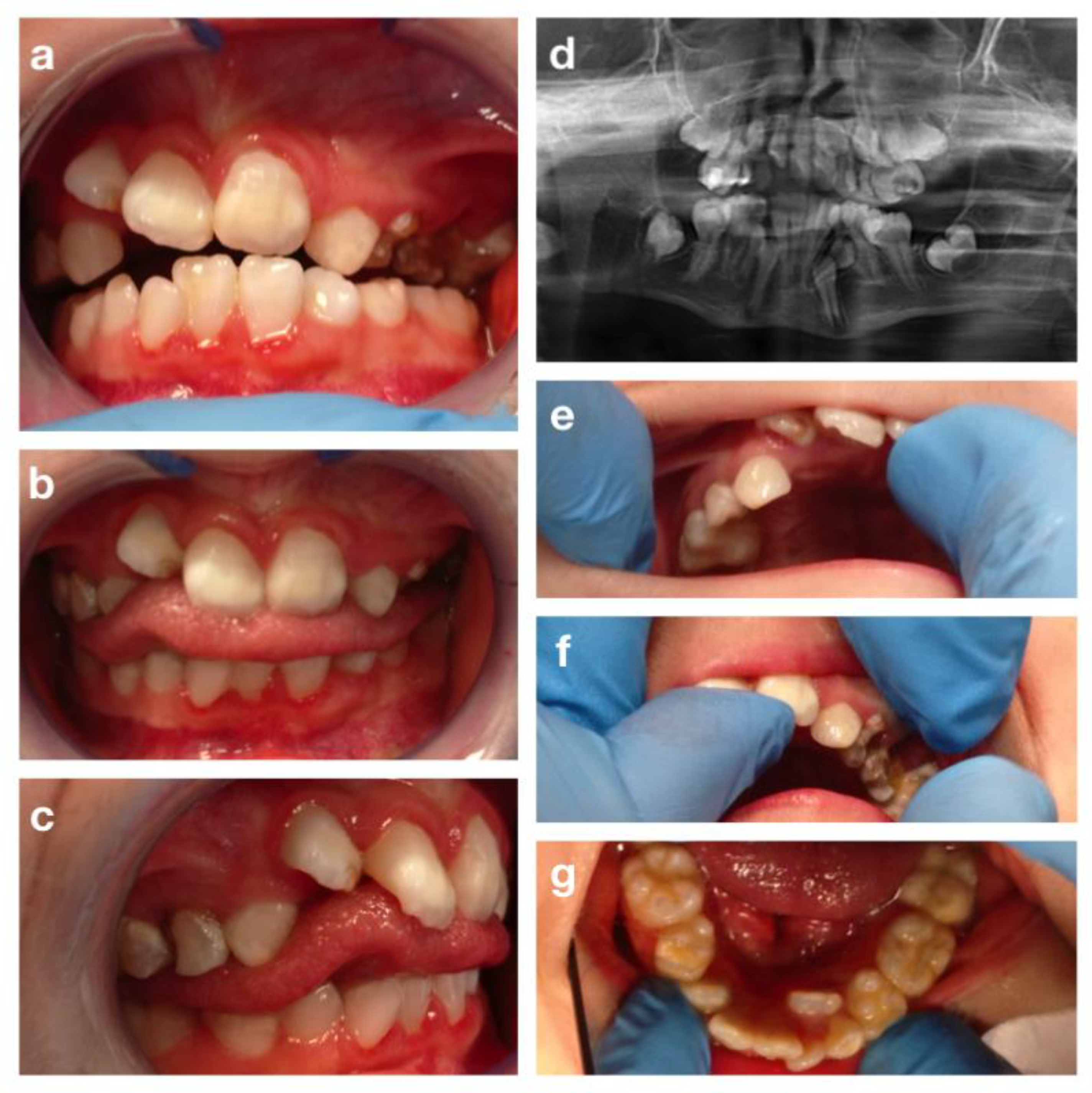 Children 09 00012 g006