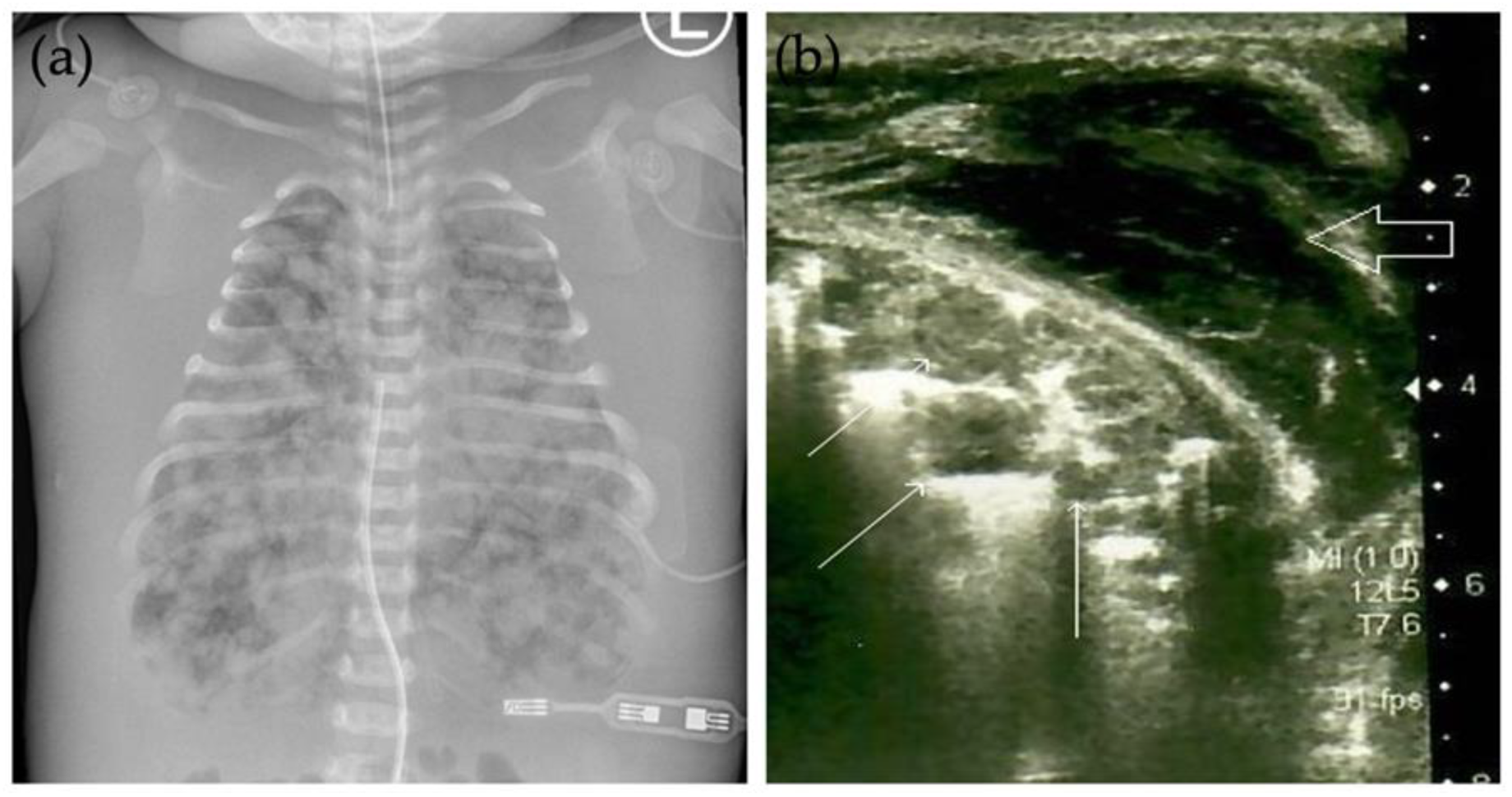 Children 09 00053 g001