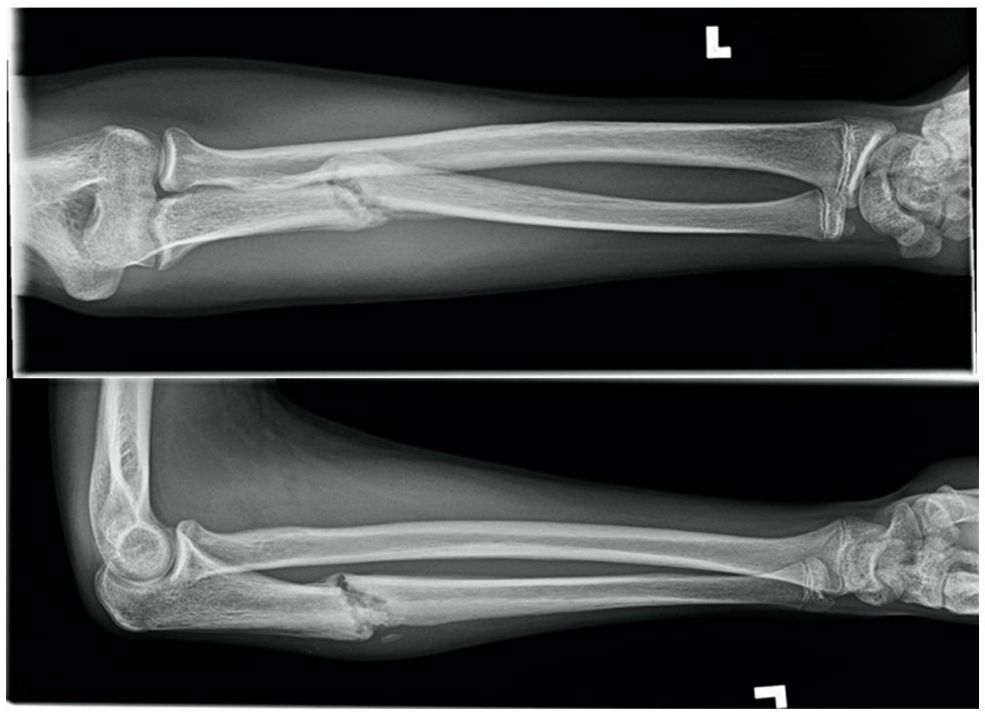 Children 09 00062 g002