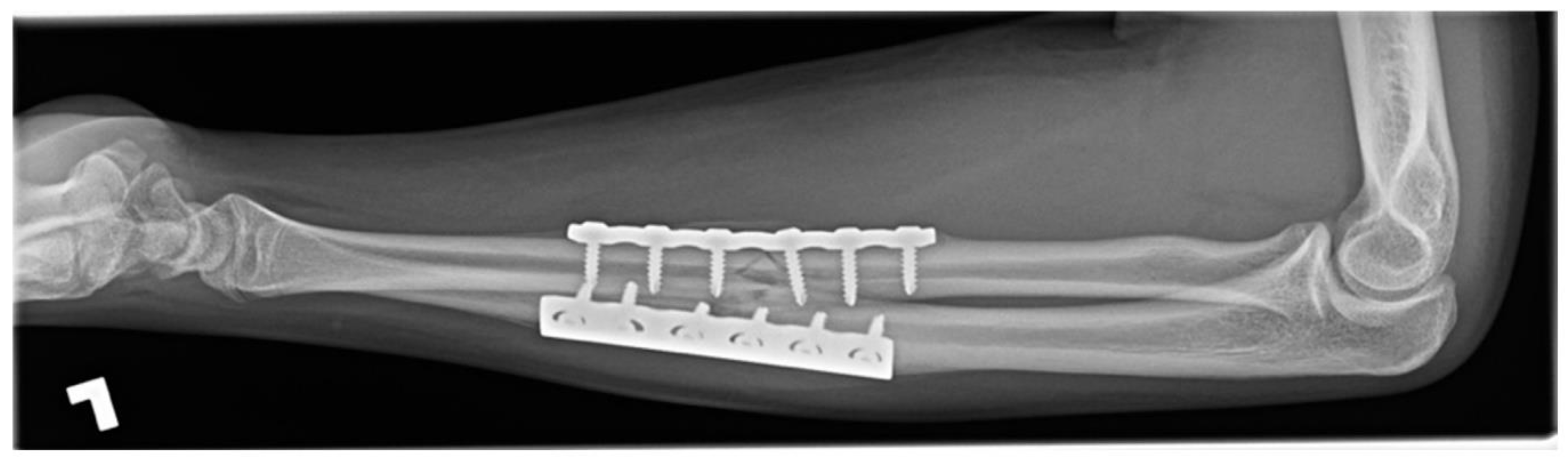 Children 09 00062 g003