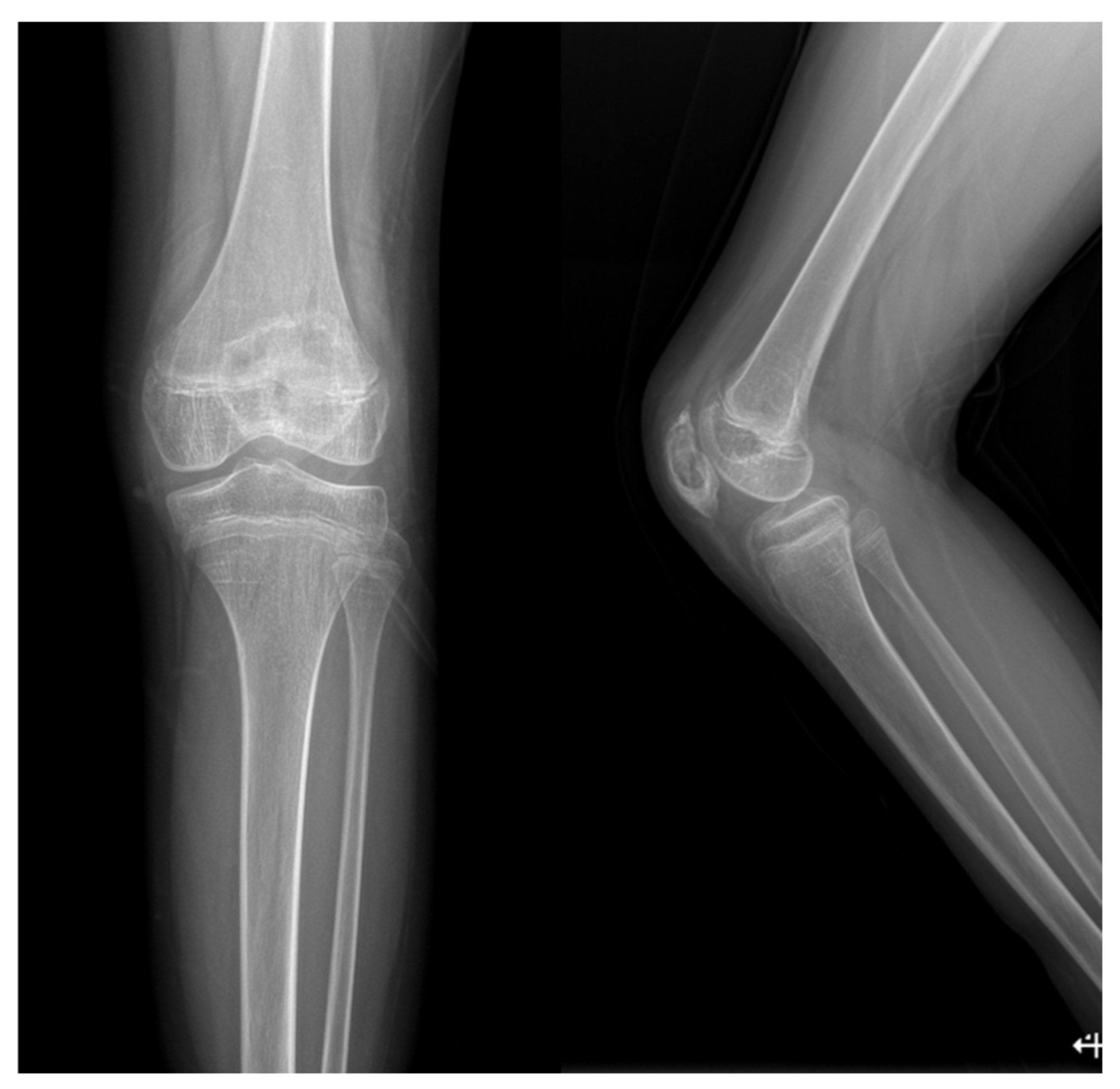 Children 09 00076 g005