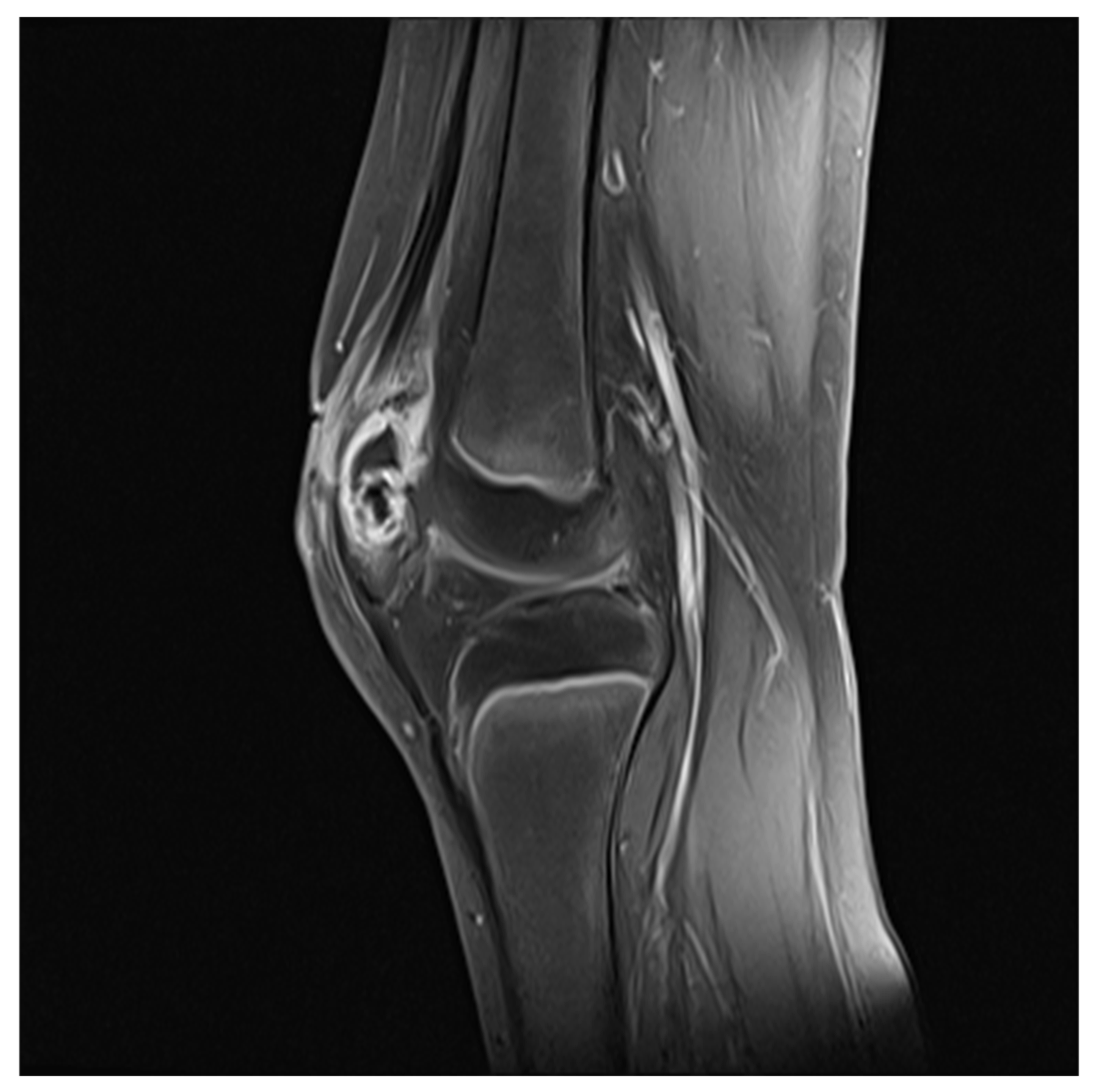 Children 09 00076 g006