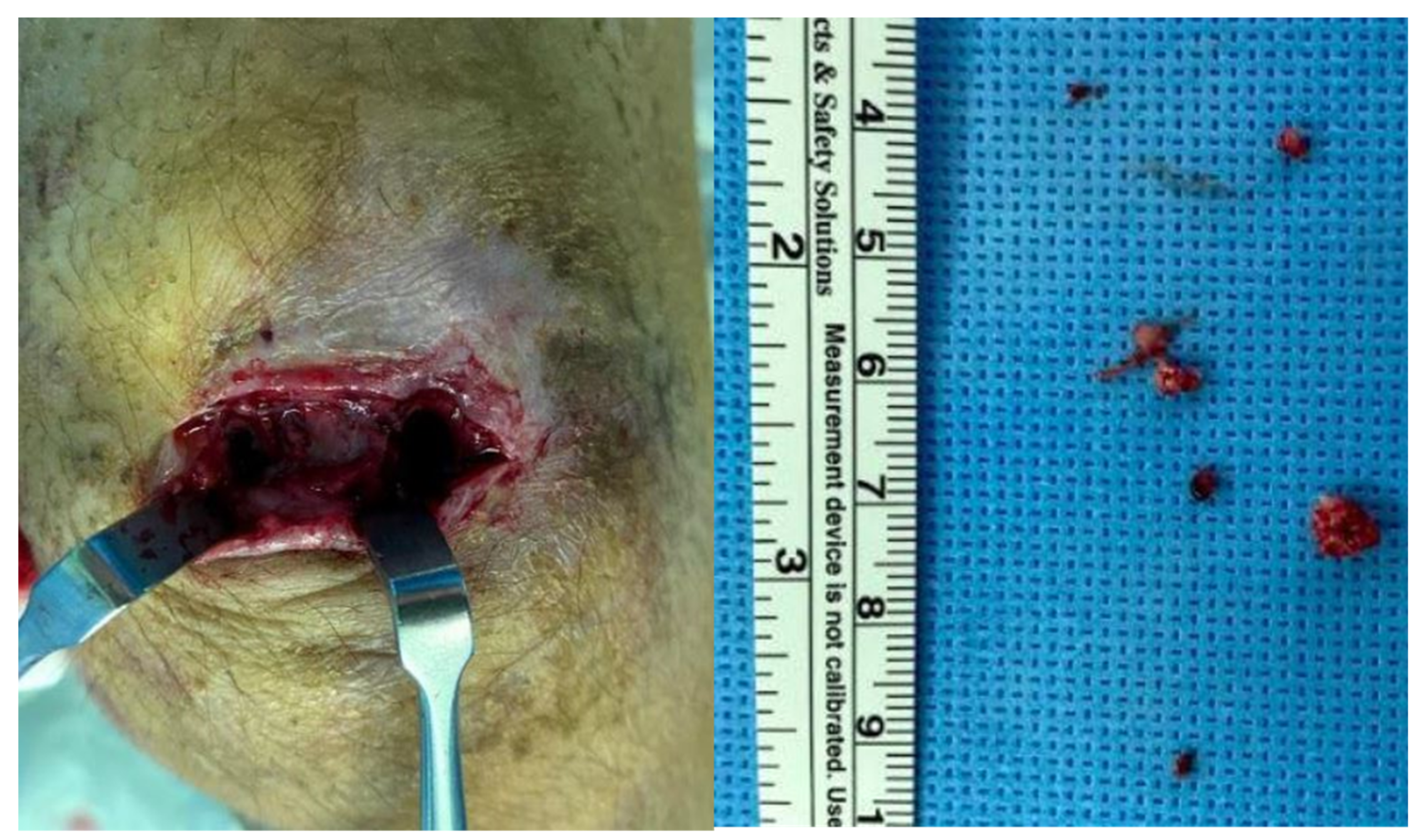 Children 09 00076 g007