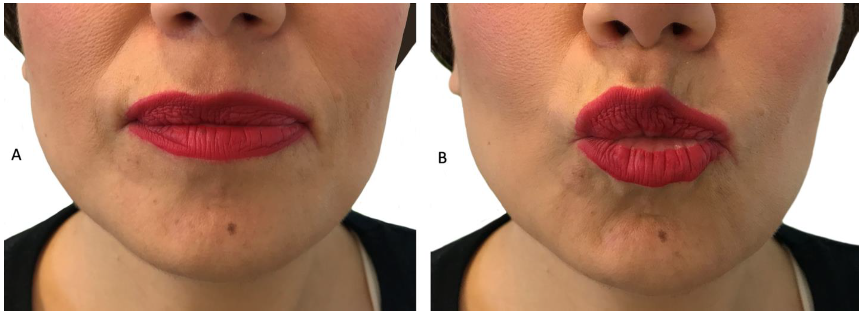 Children 09 00096 g003