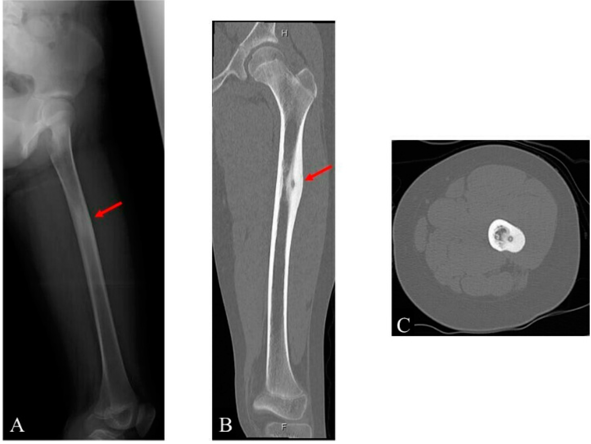 Children 09 00158 g001