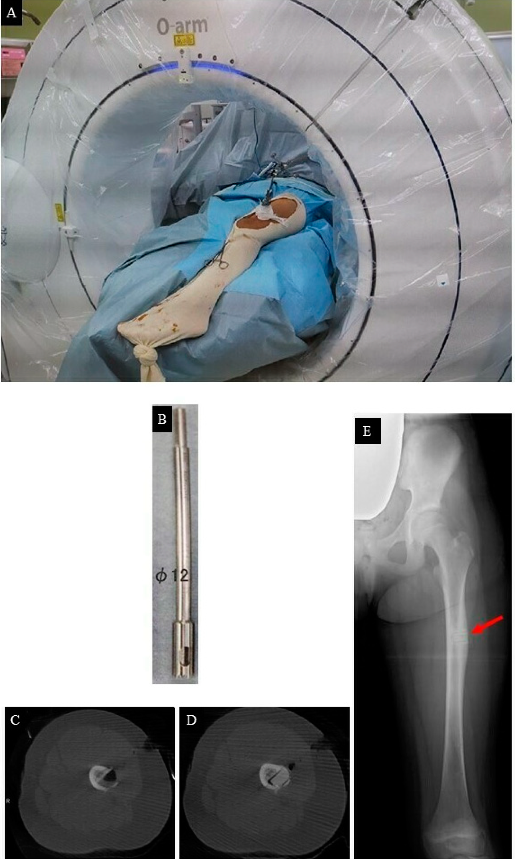 Children 09 00158 g003