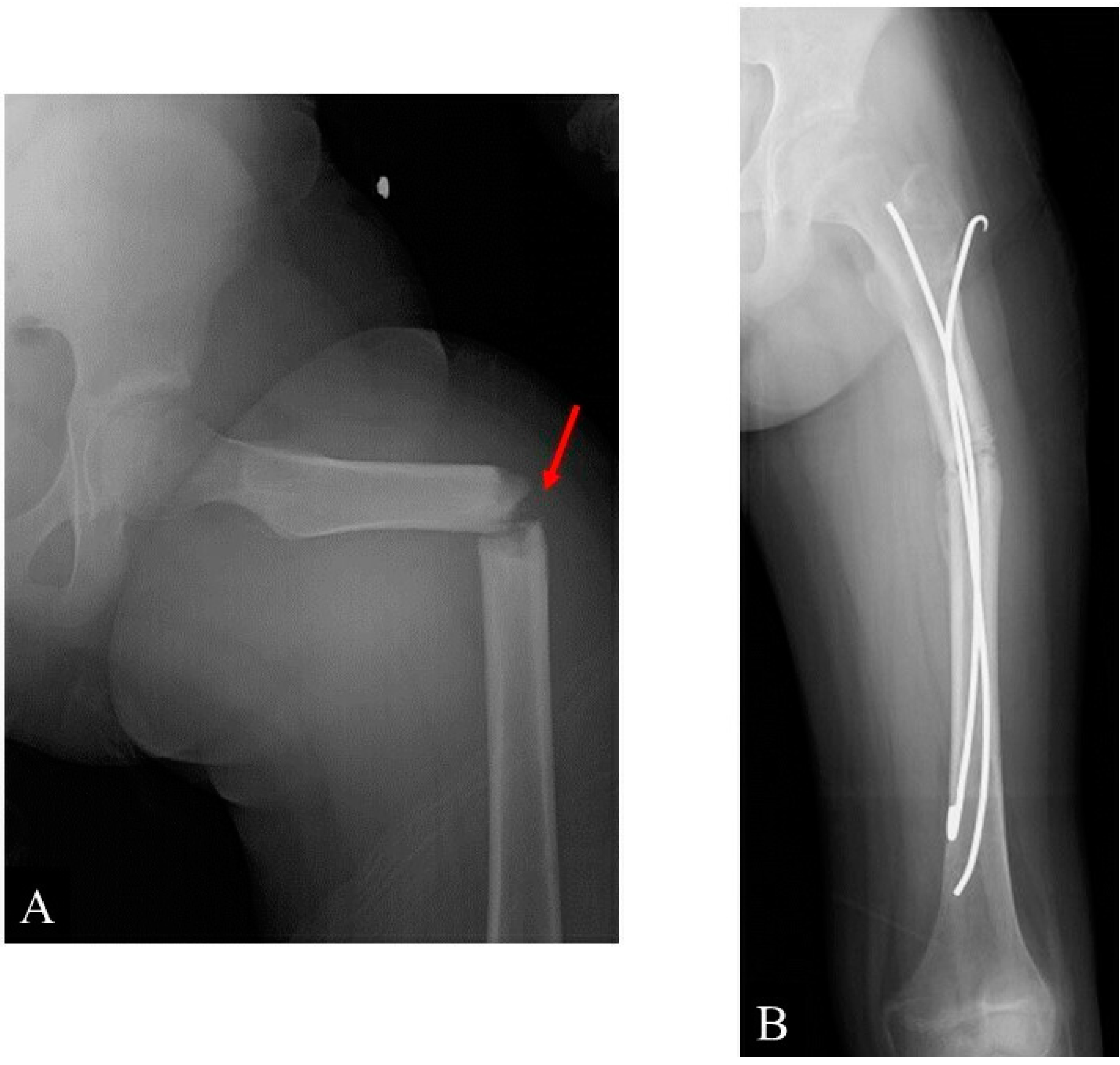 Children 09 00158 g005