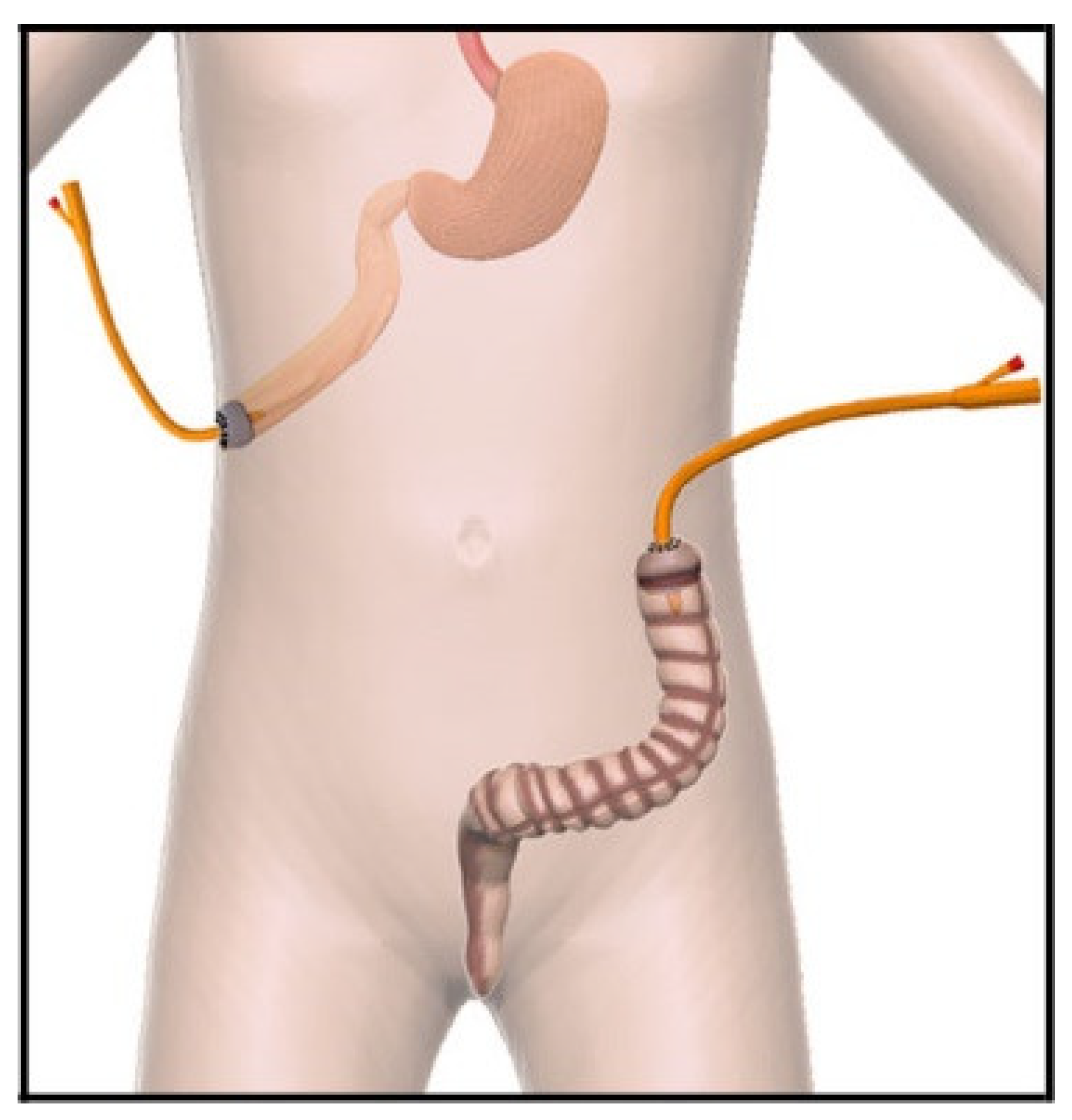 Children 09 00162 g001