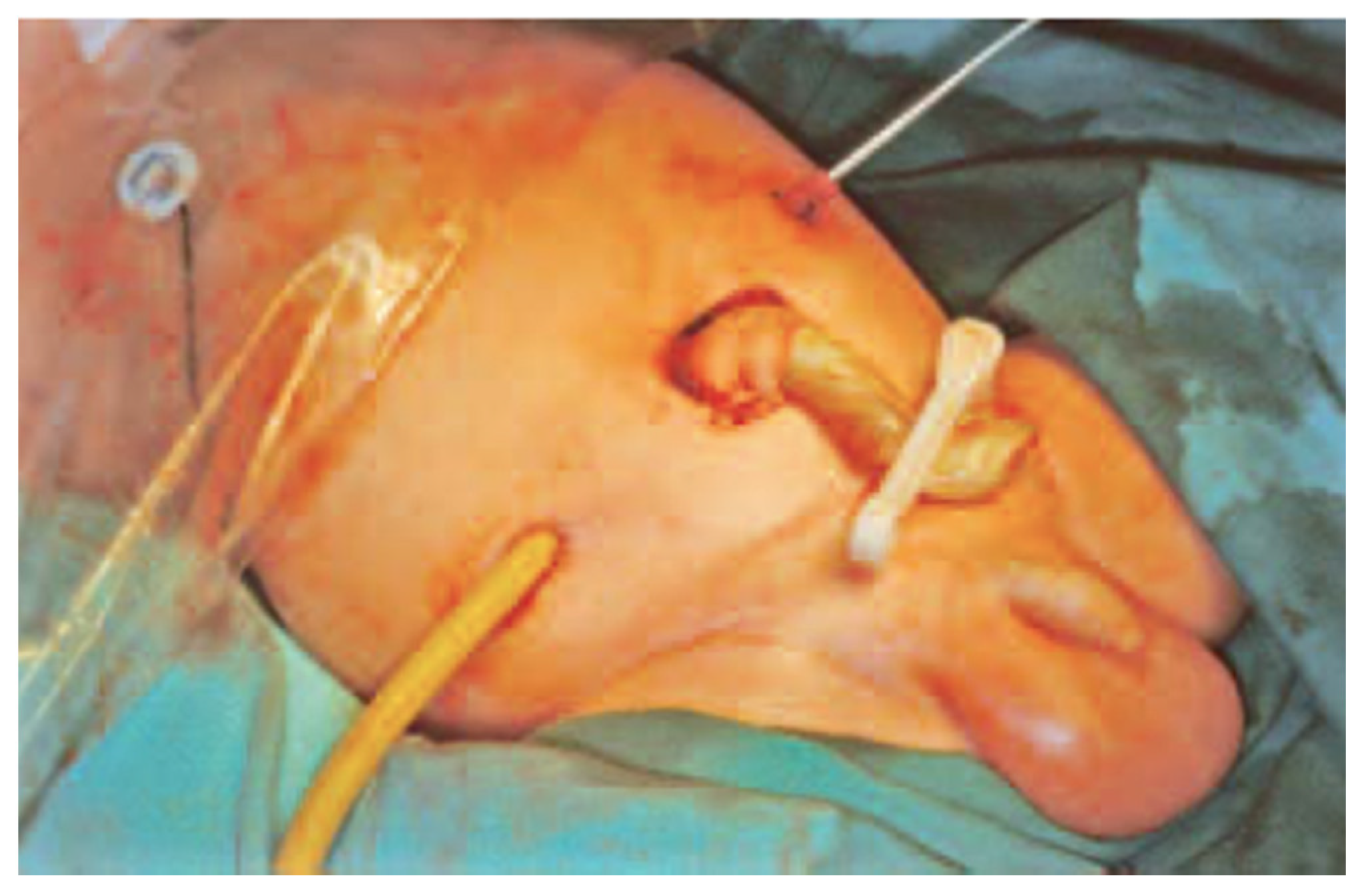 Children 09 00162 g002