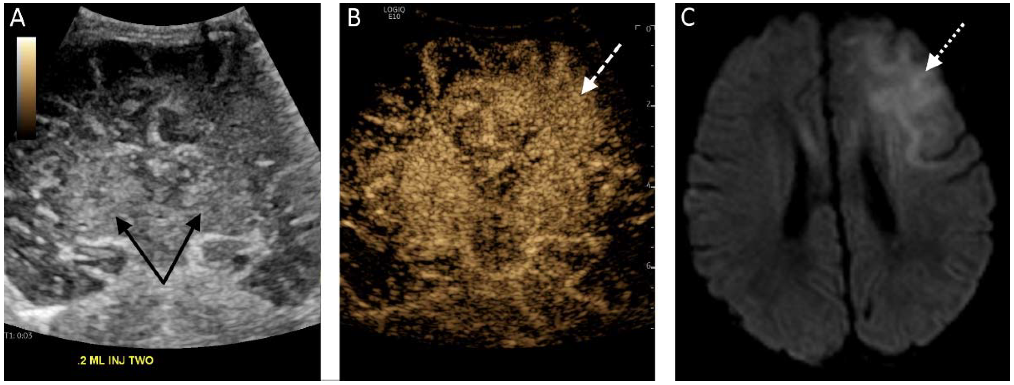 Children 09 00170 g001