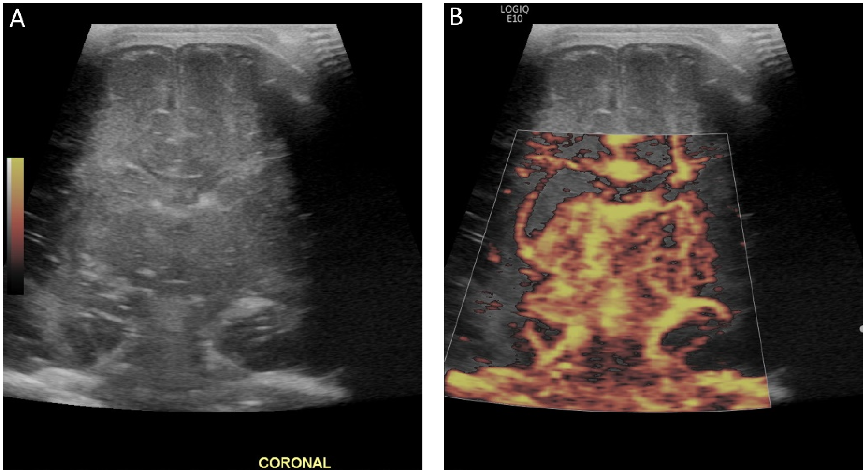 Children 09 00170 g006