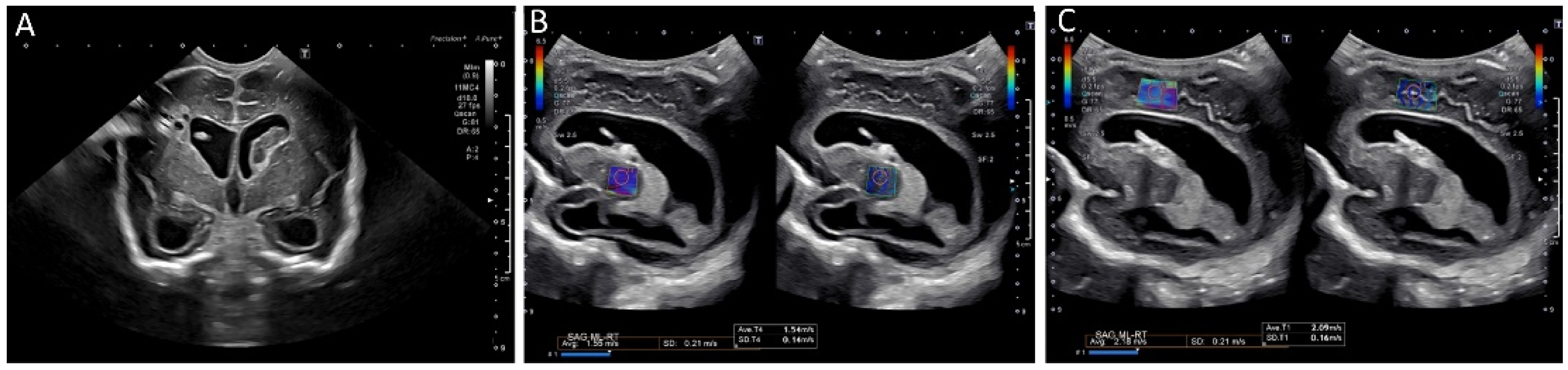 Children 09 00170 g008