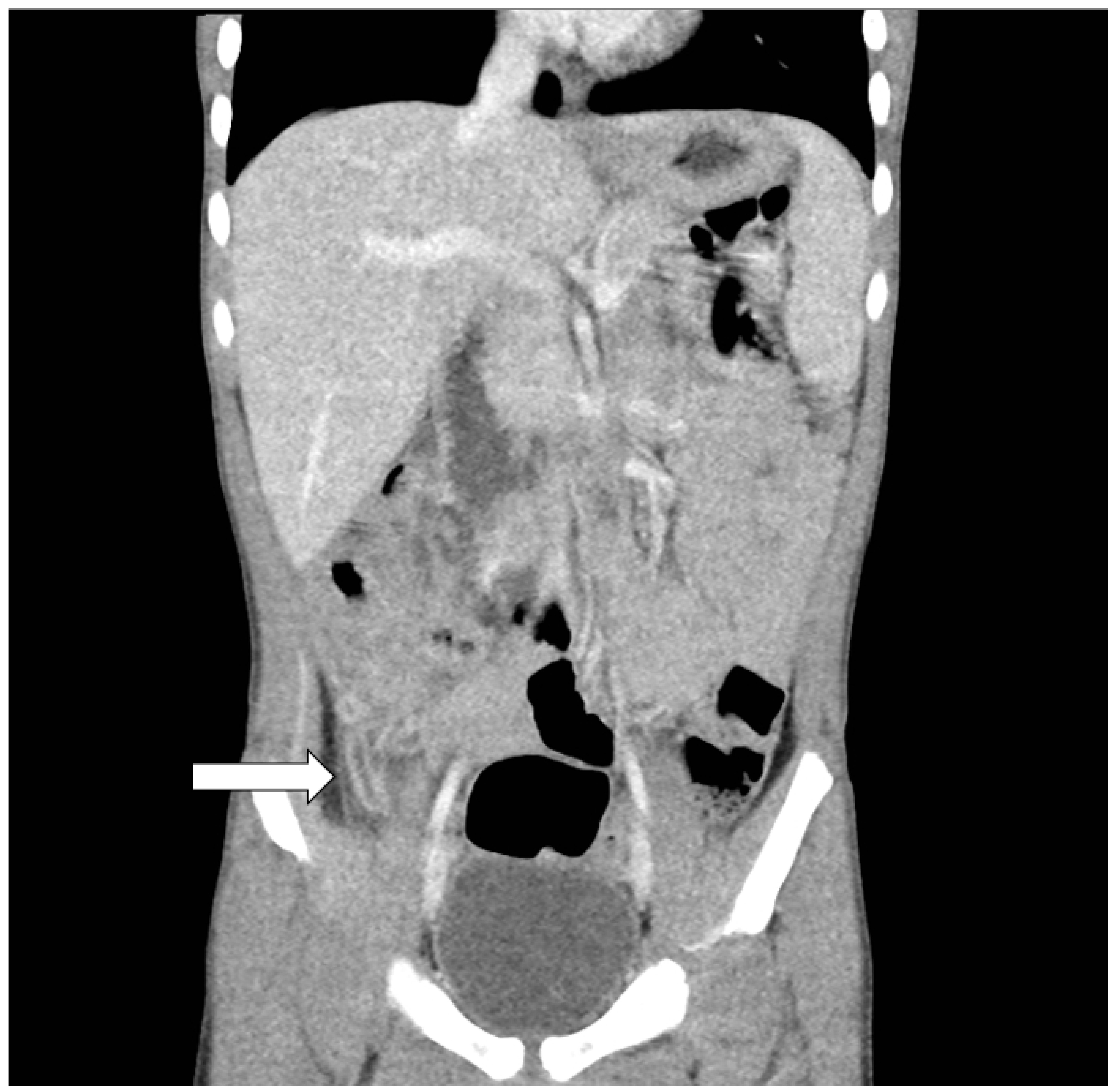 Children 09 00193 g001