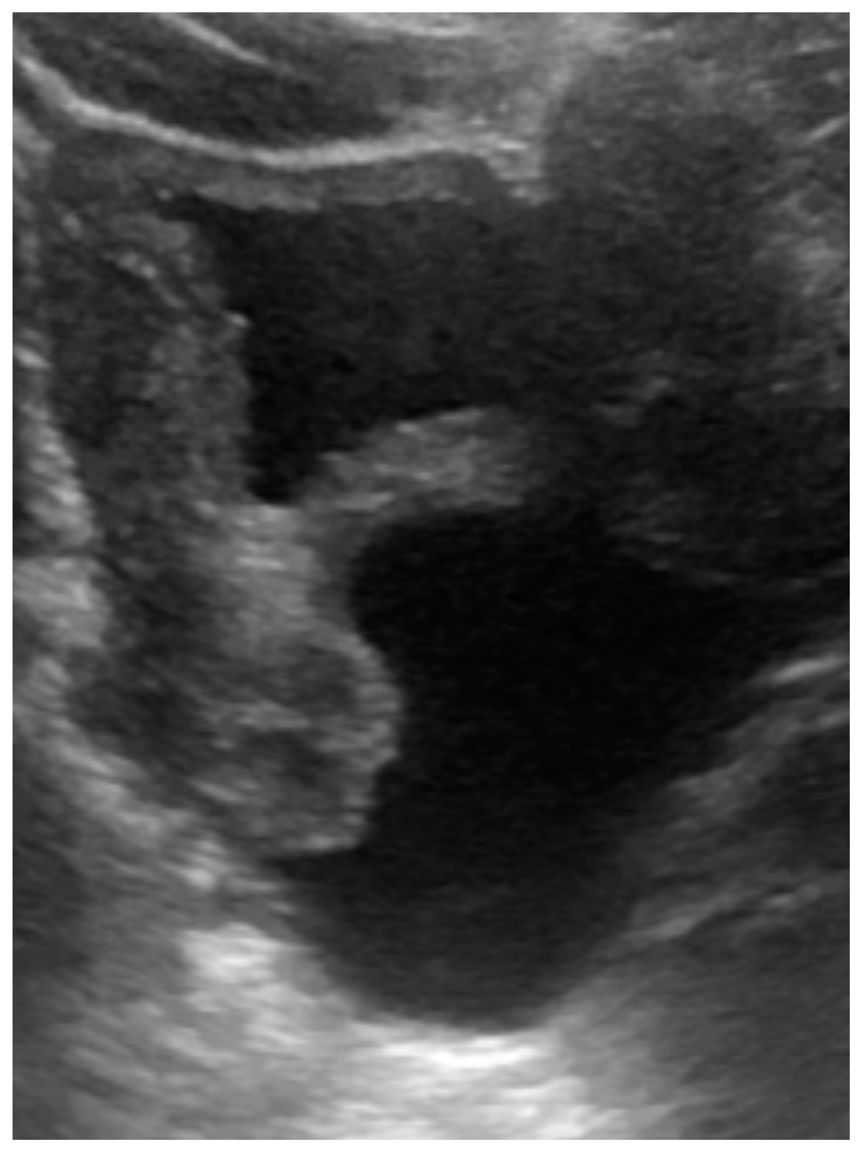 Children 09 00219 g003