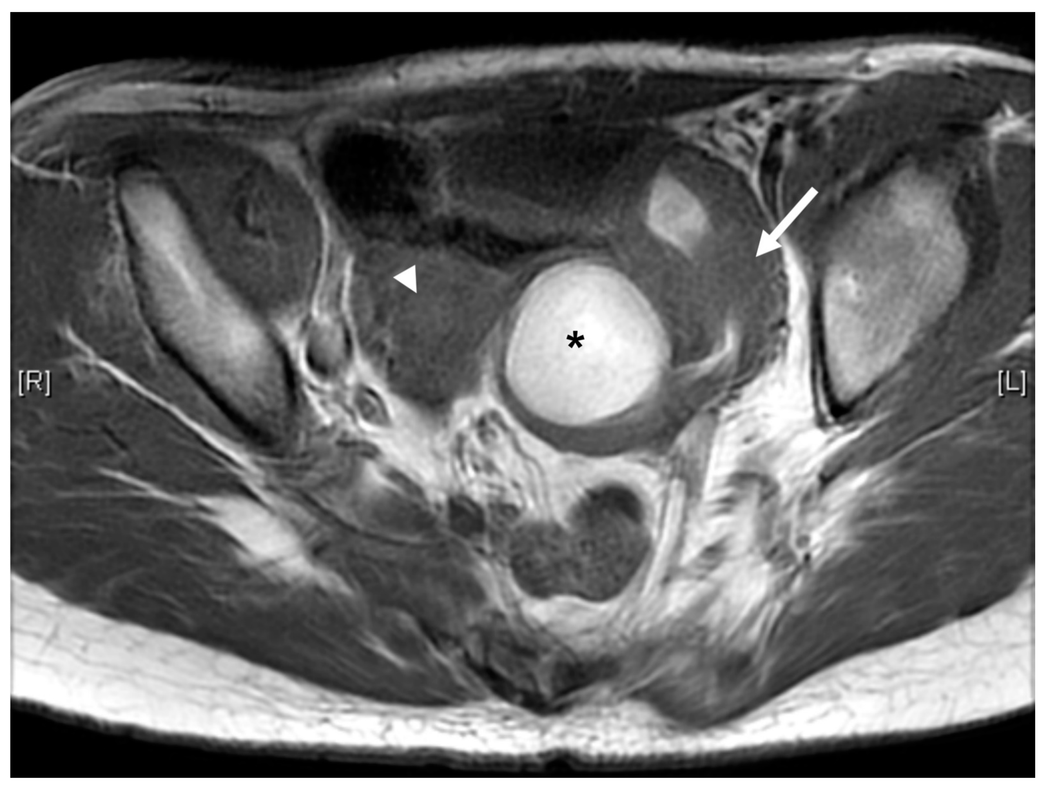 Children 09 00219 g004