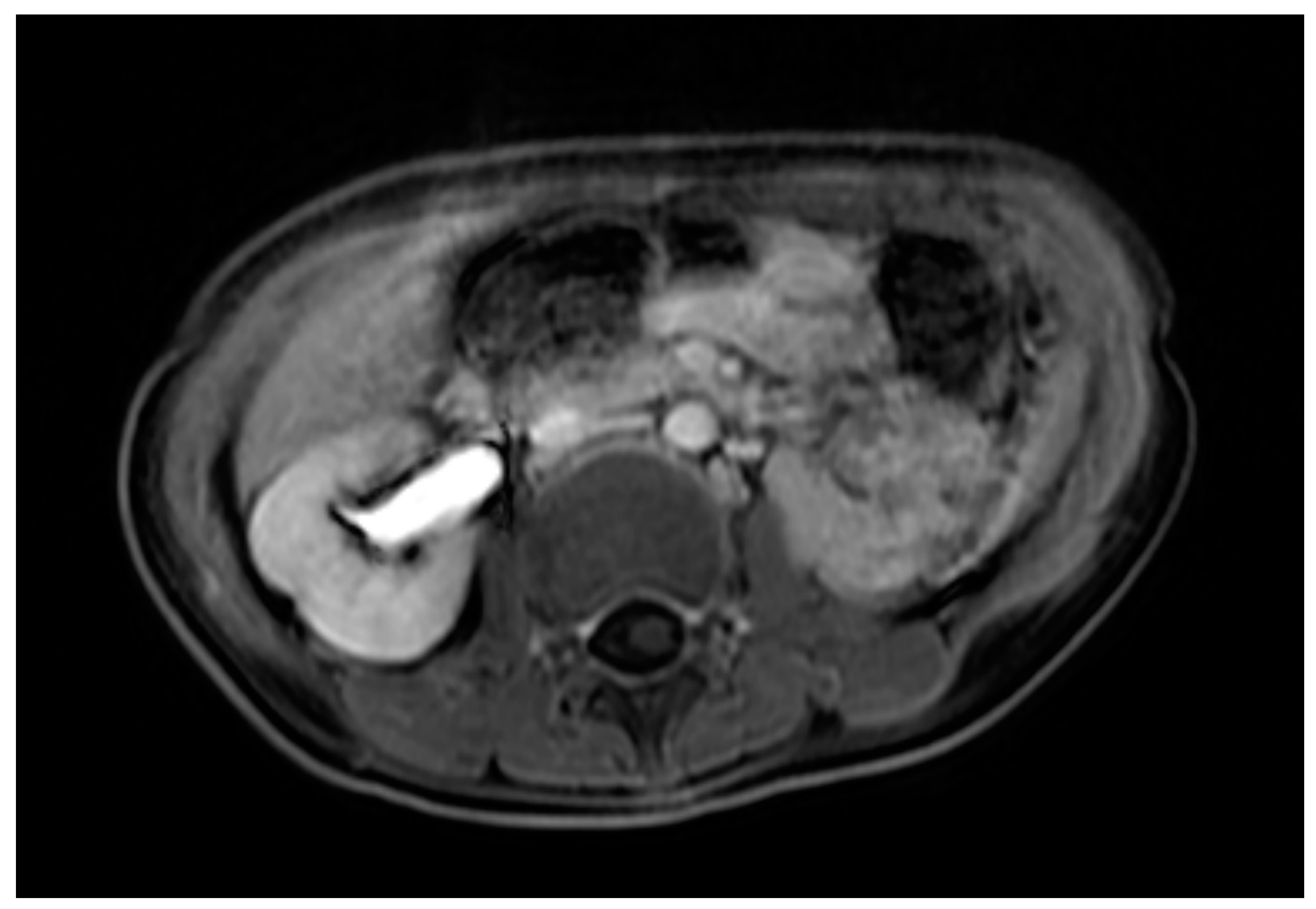 Children 09 00219 g005