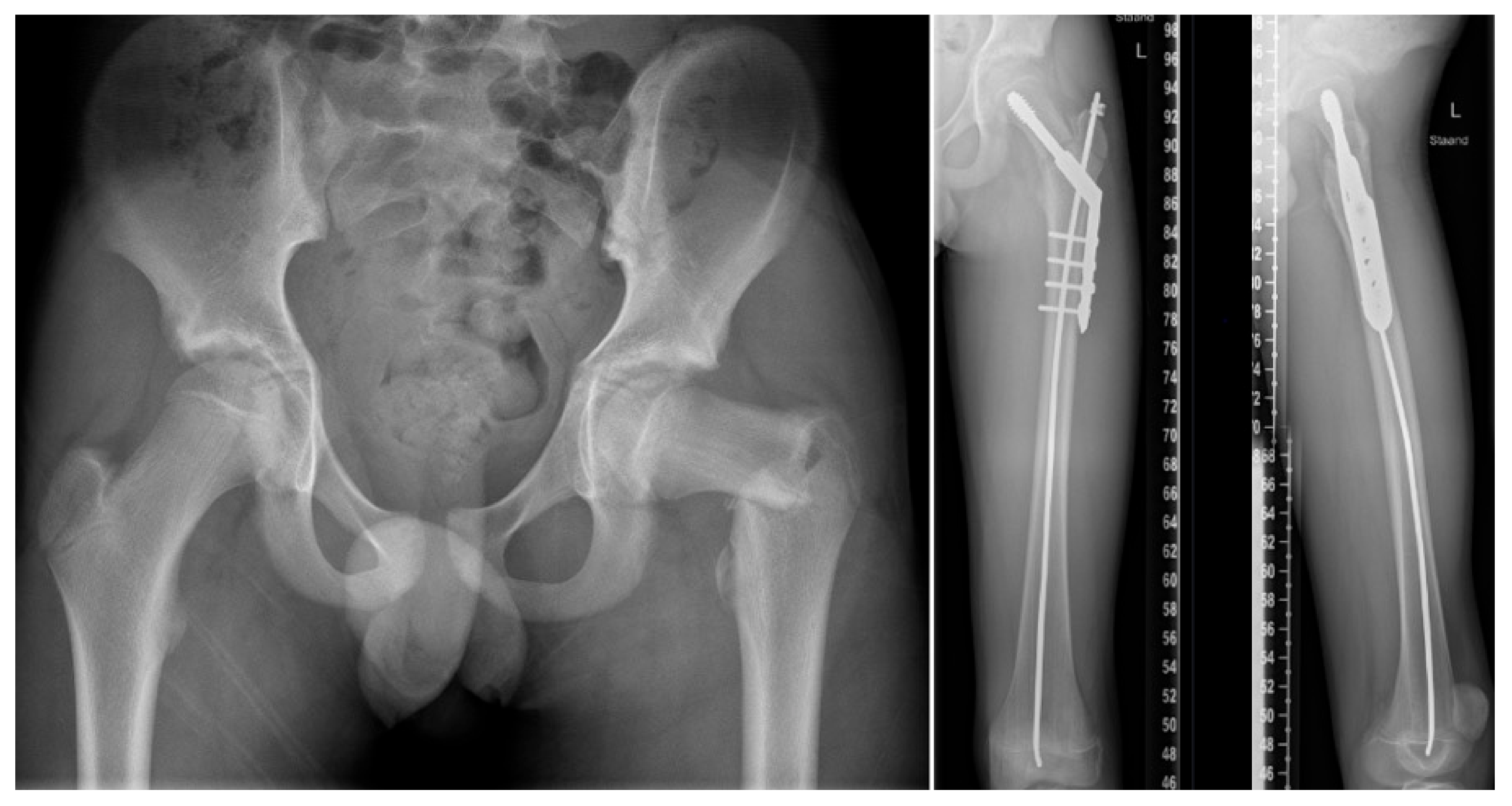 Children 09 00268 g004