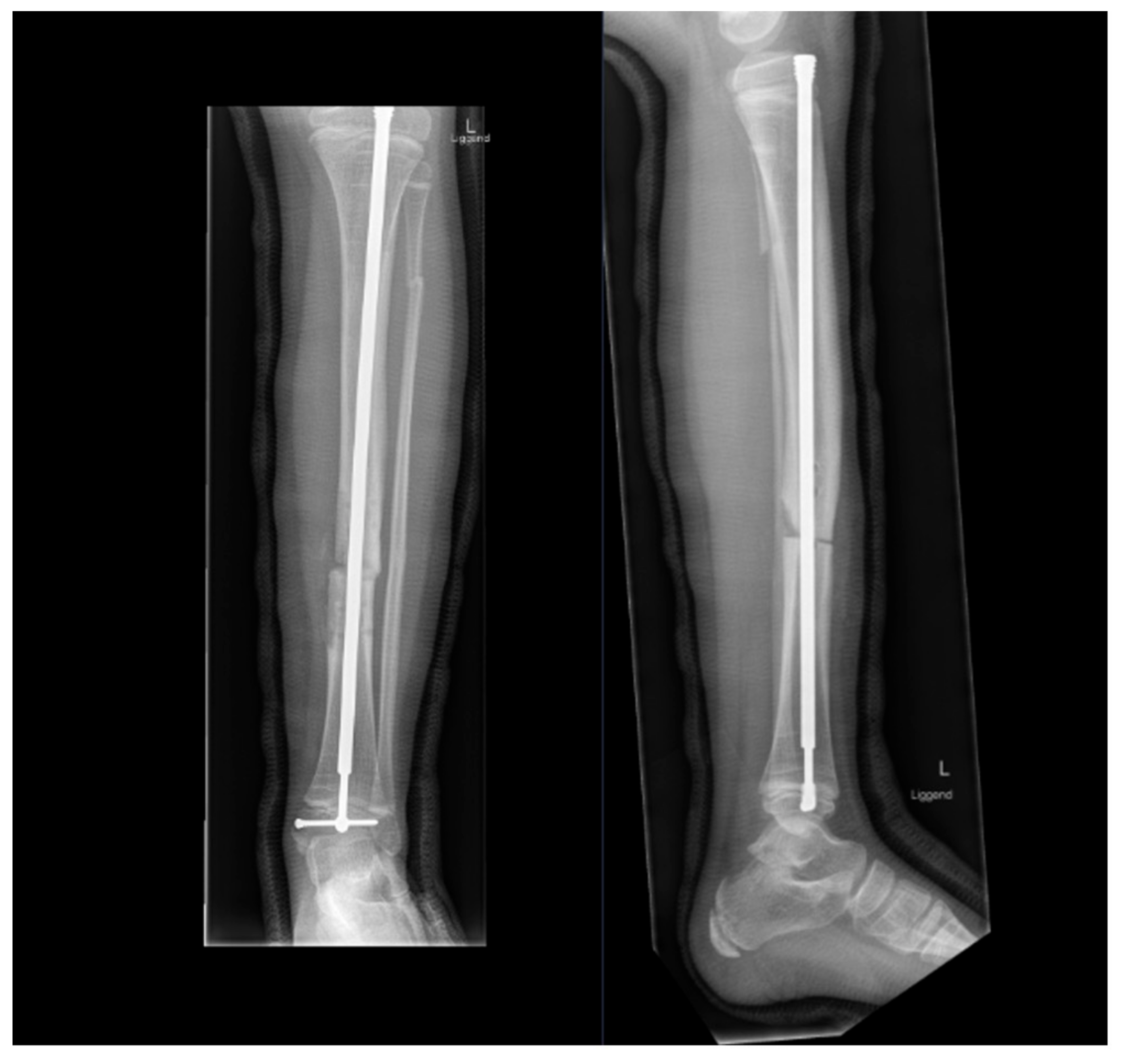 Children 09 00268 g005