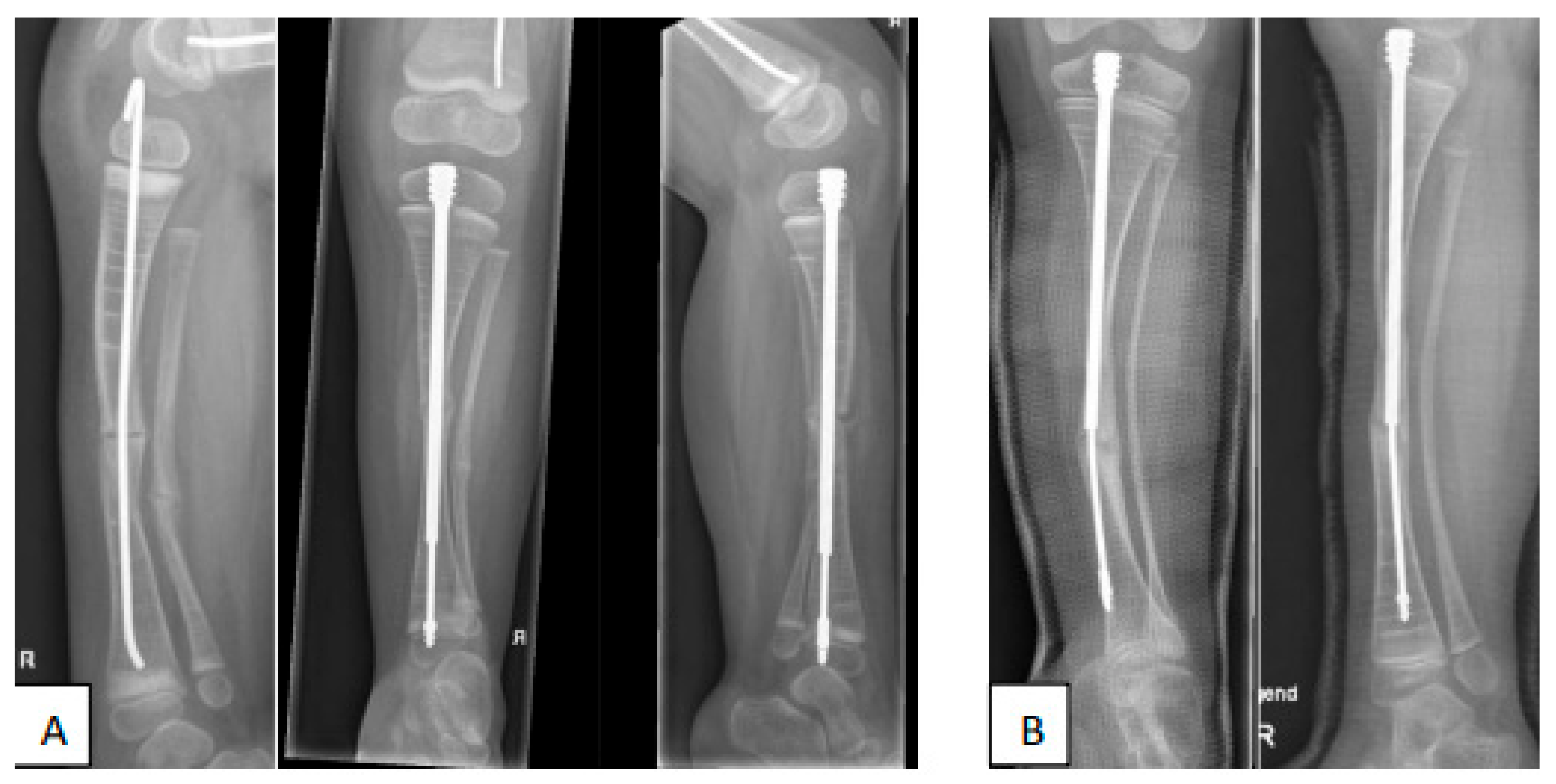 Children 09 00268 g006