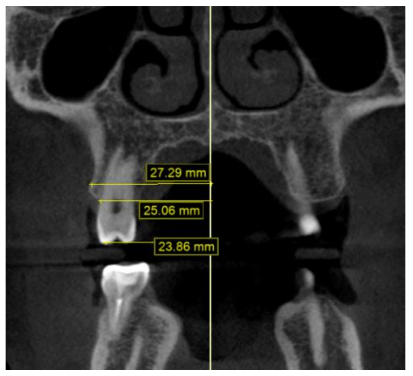 Children 09 00278 g005