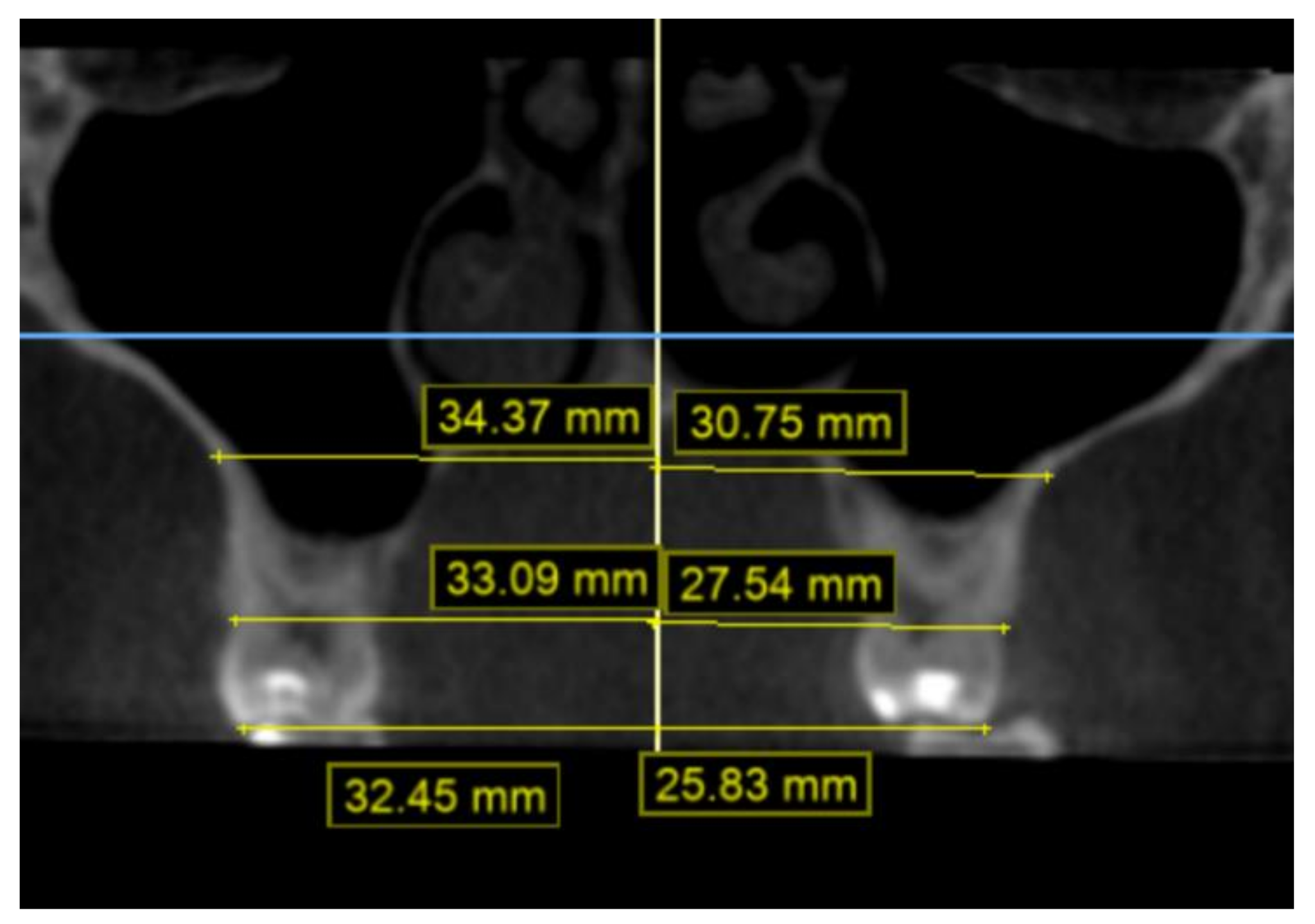 Children 09 00278 g007