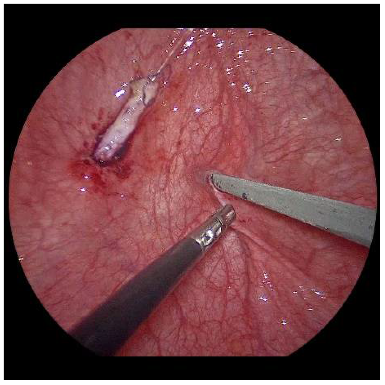 Children 09 00298 g005