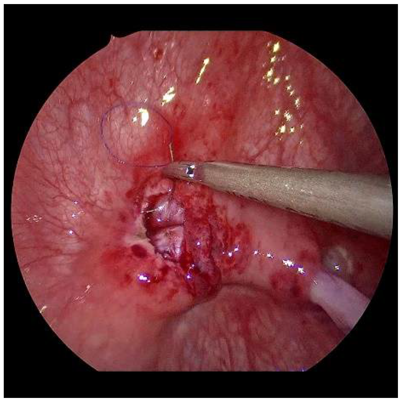 Children 09 00298 g006