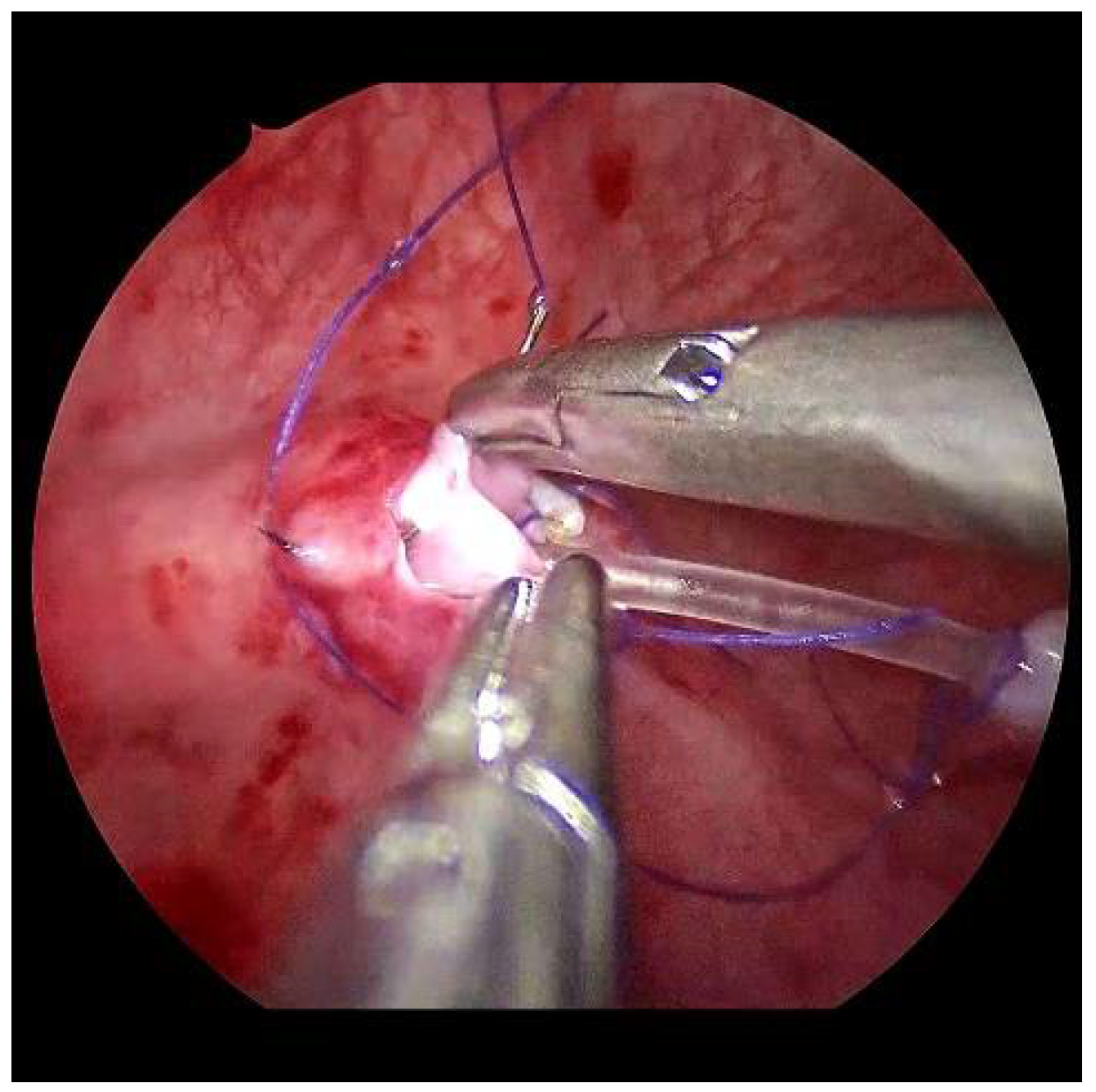 Children 09 00298 g007