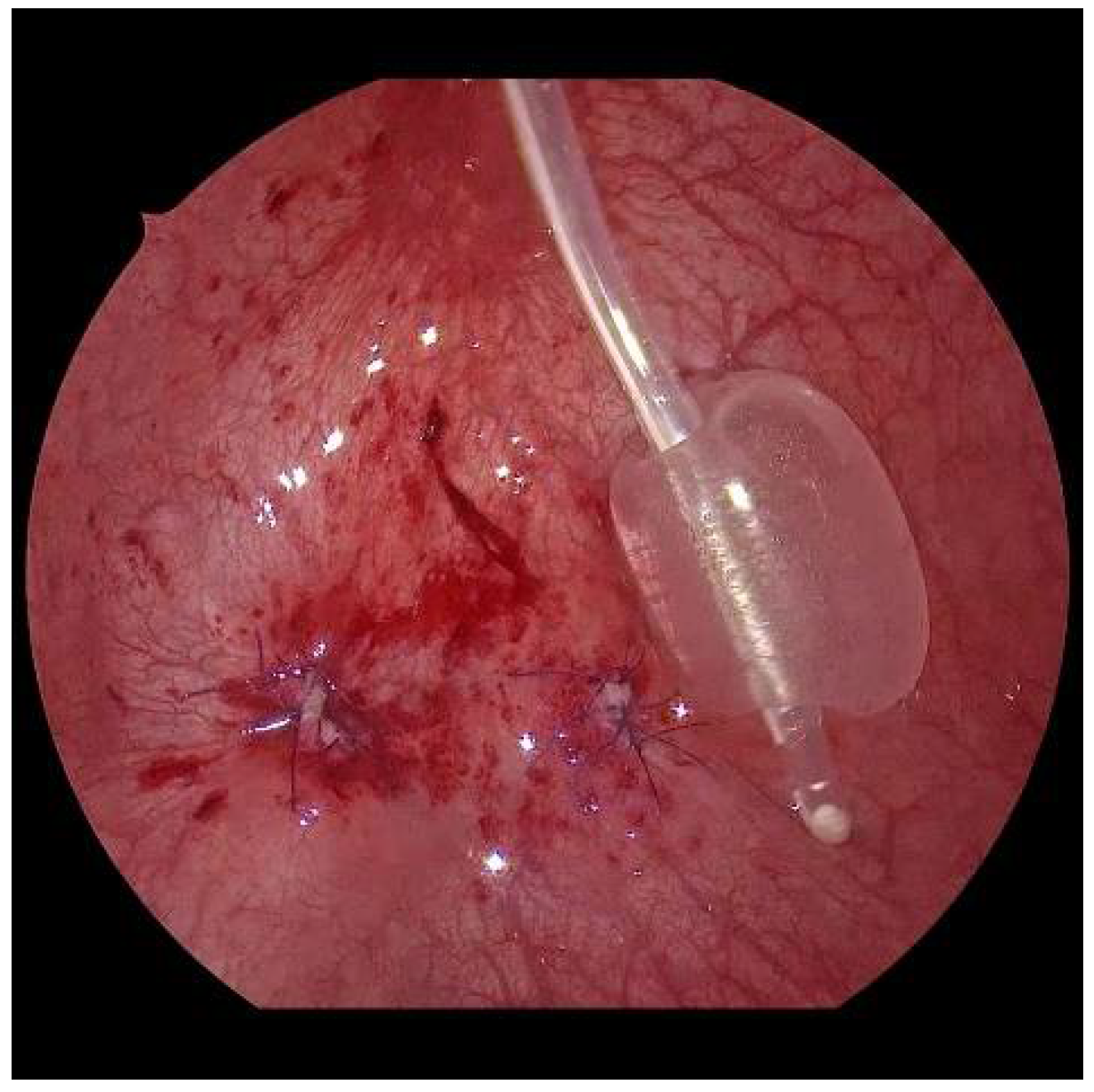 Children 09 00298 g008