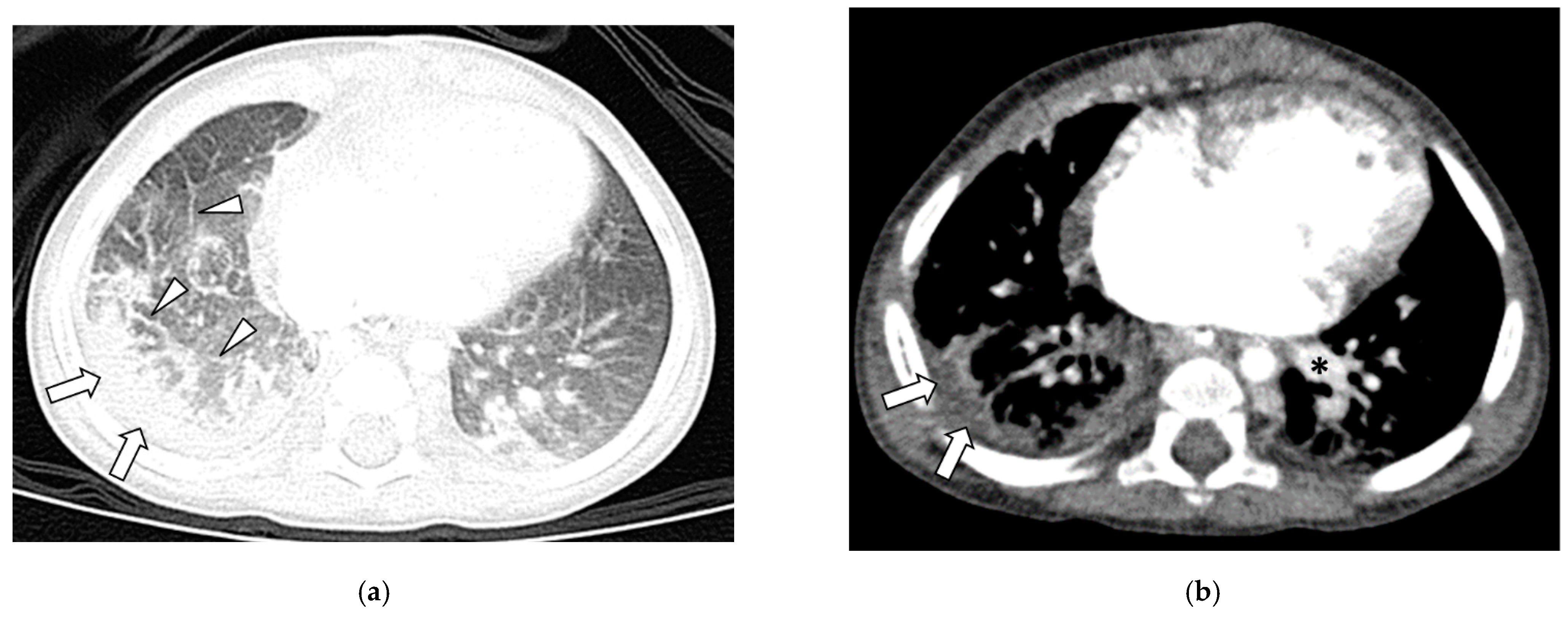 Children 09 00355 g001