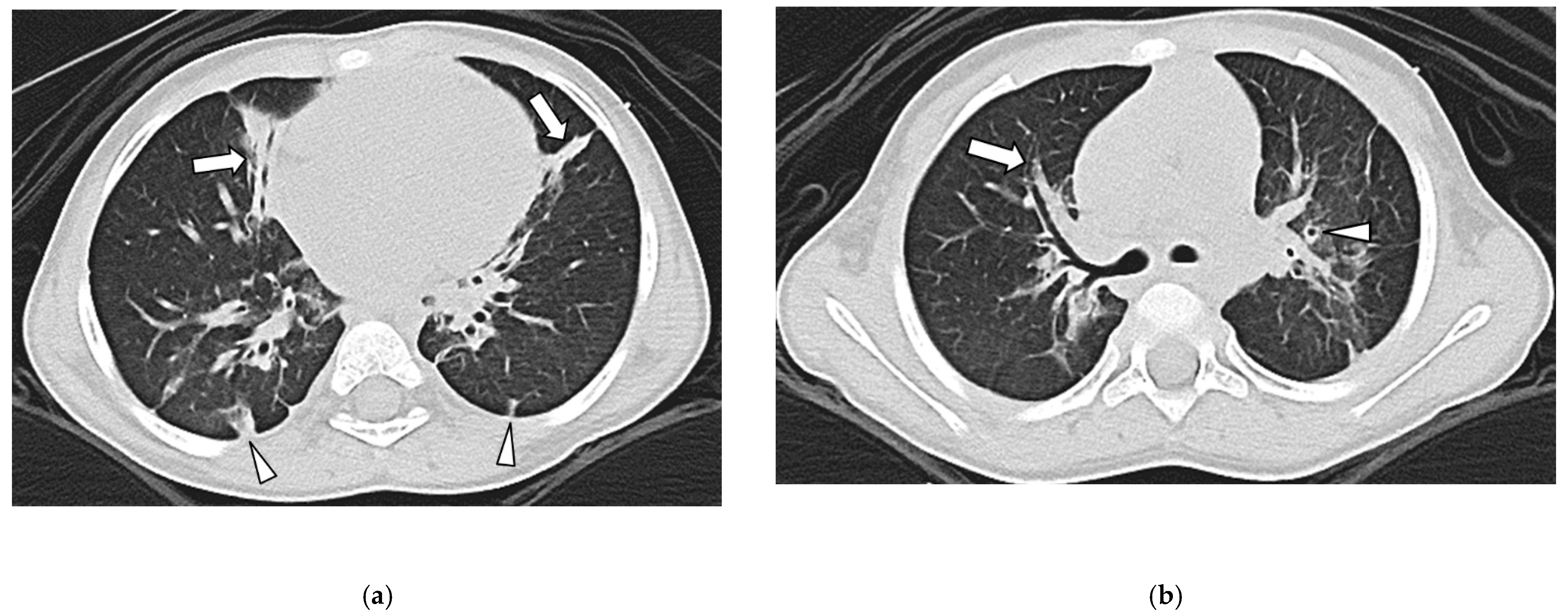 Children 09 00355 g003