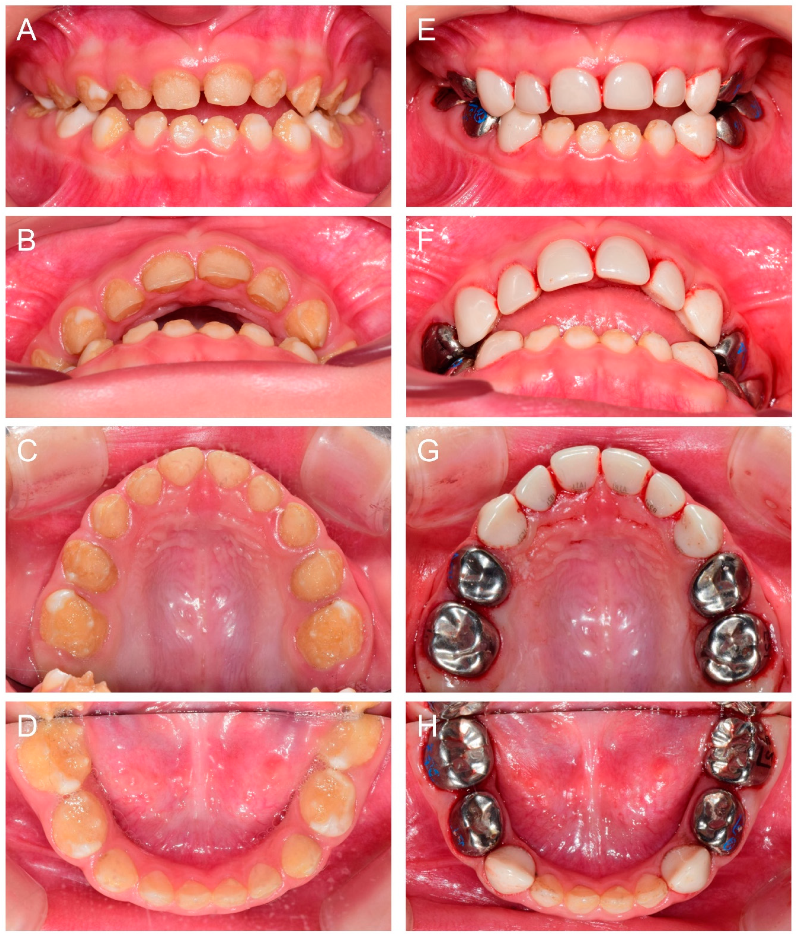 Children 09 00429 g002