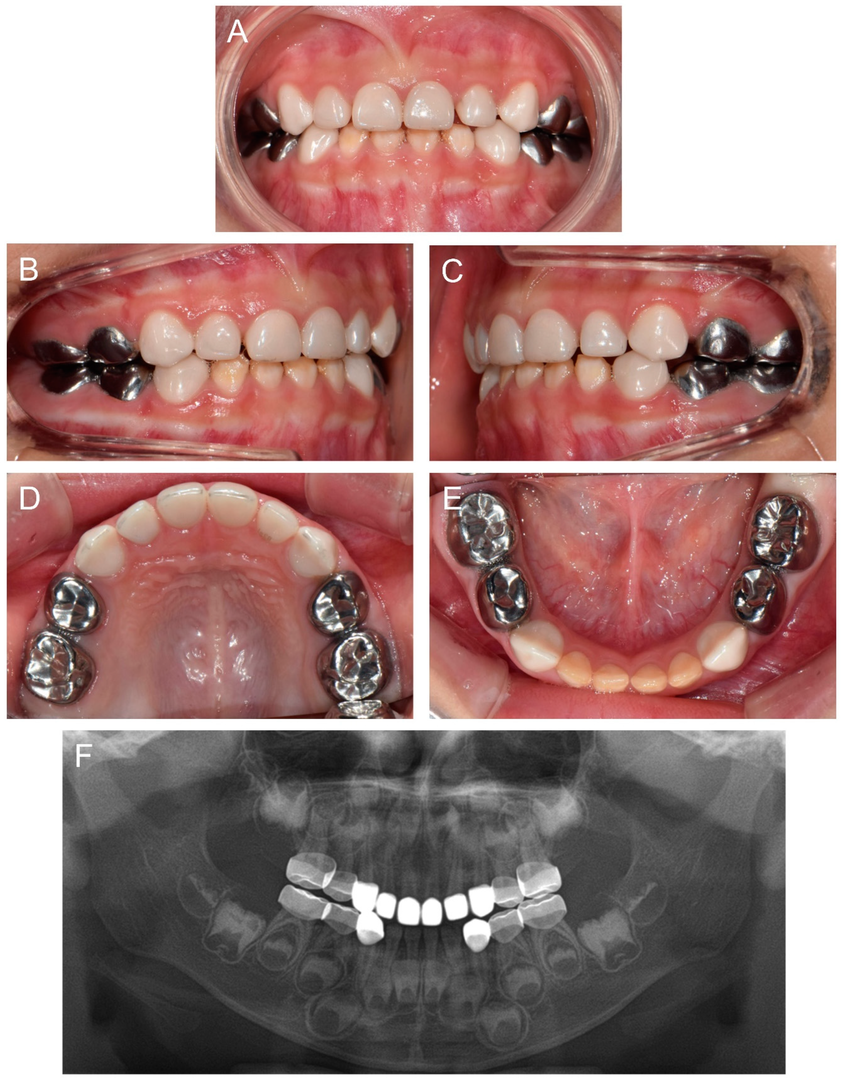 Children 09 00429 g003