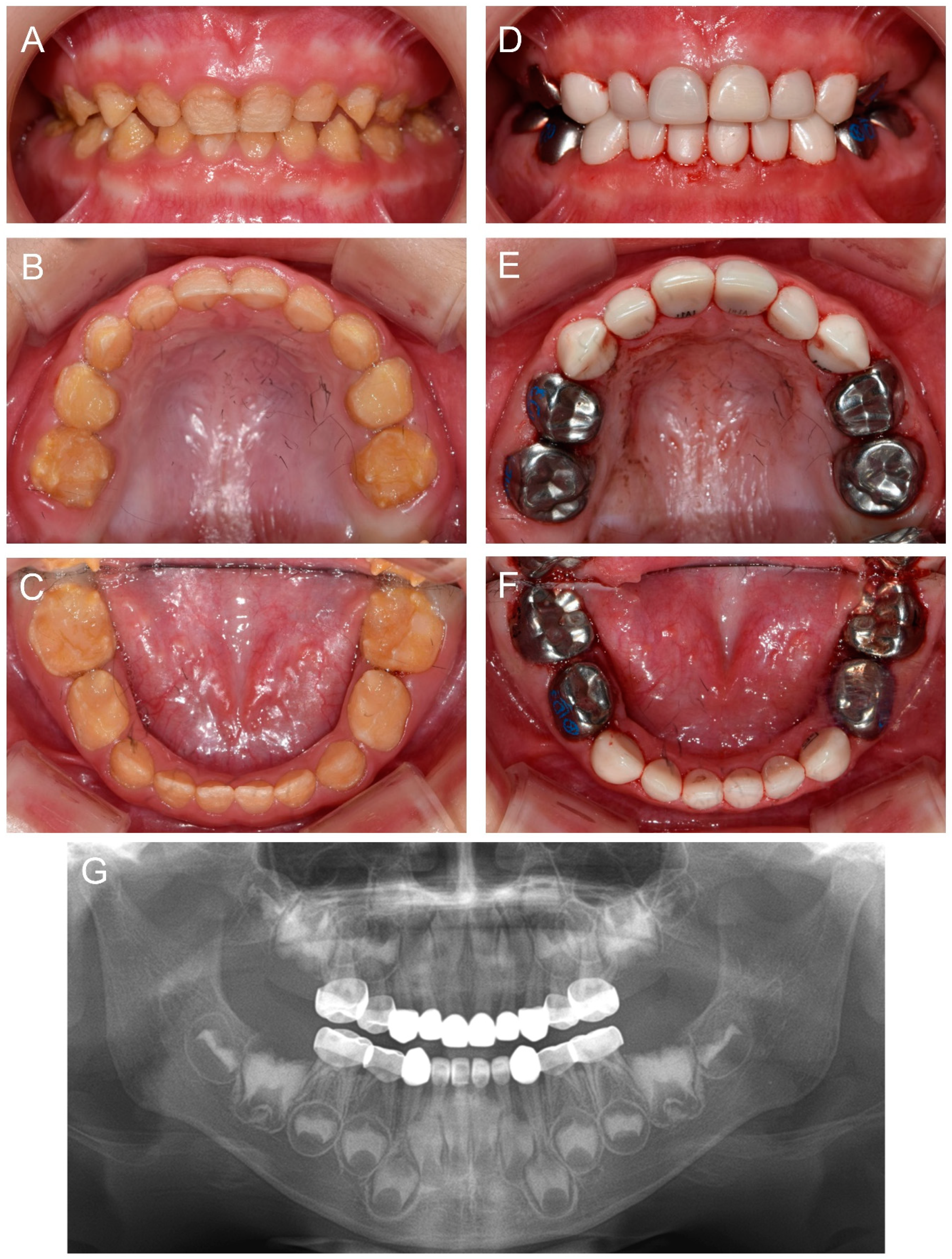 Children 09 00429 g004