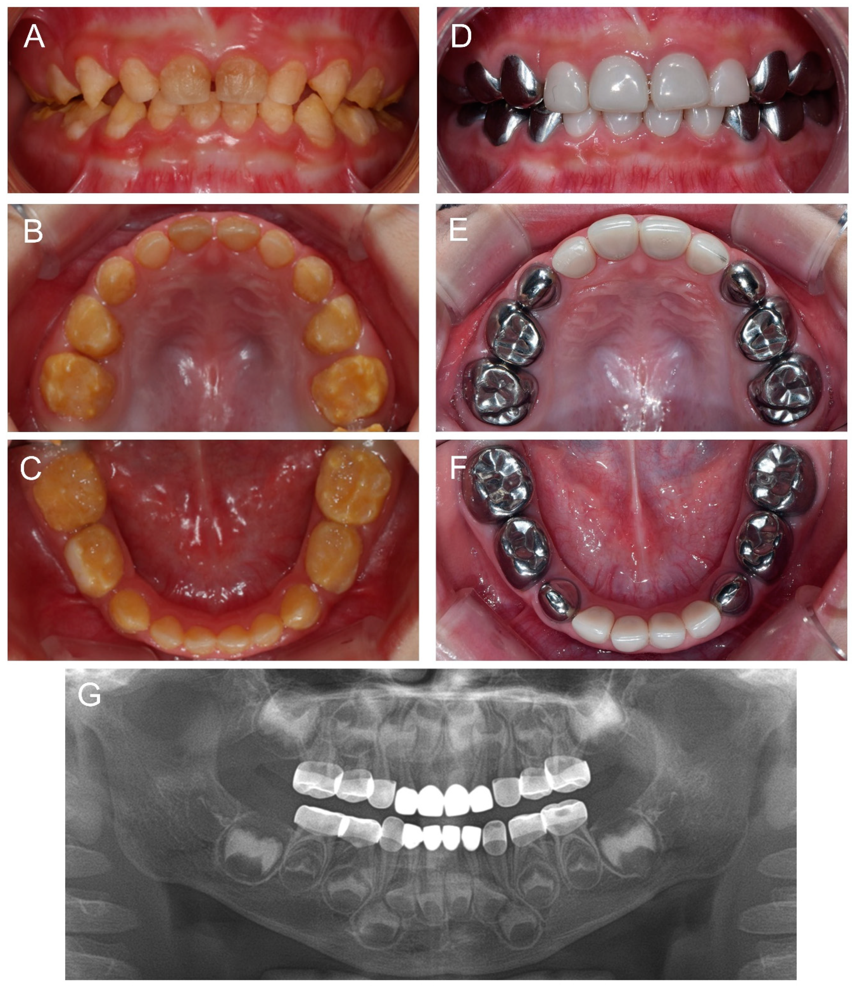 Children 09 00429 g005