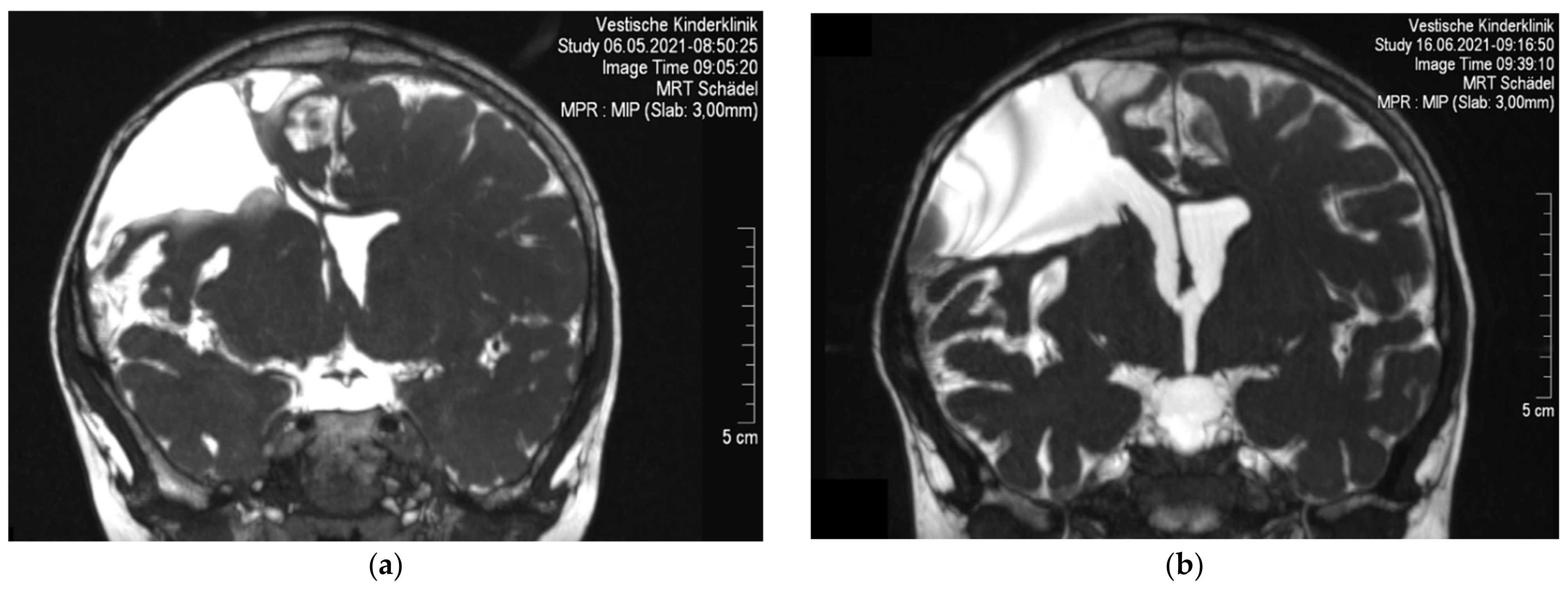 Children 09 00432 g002