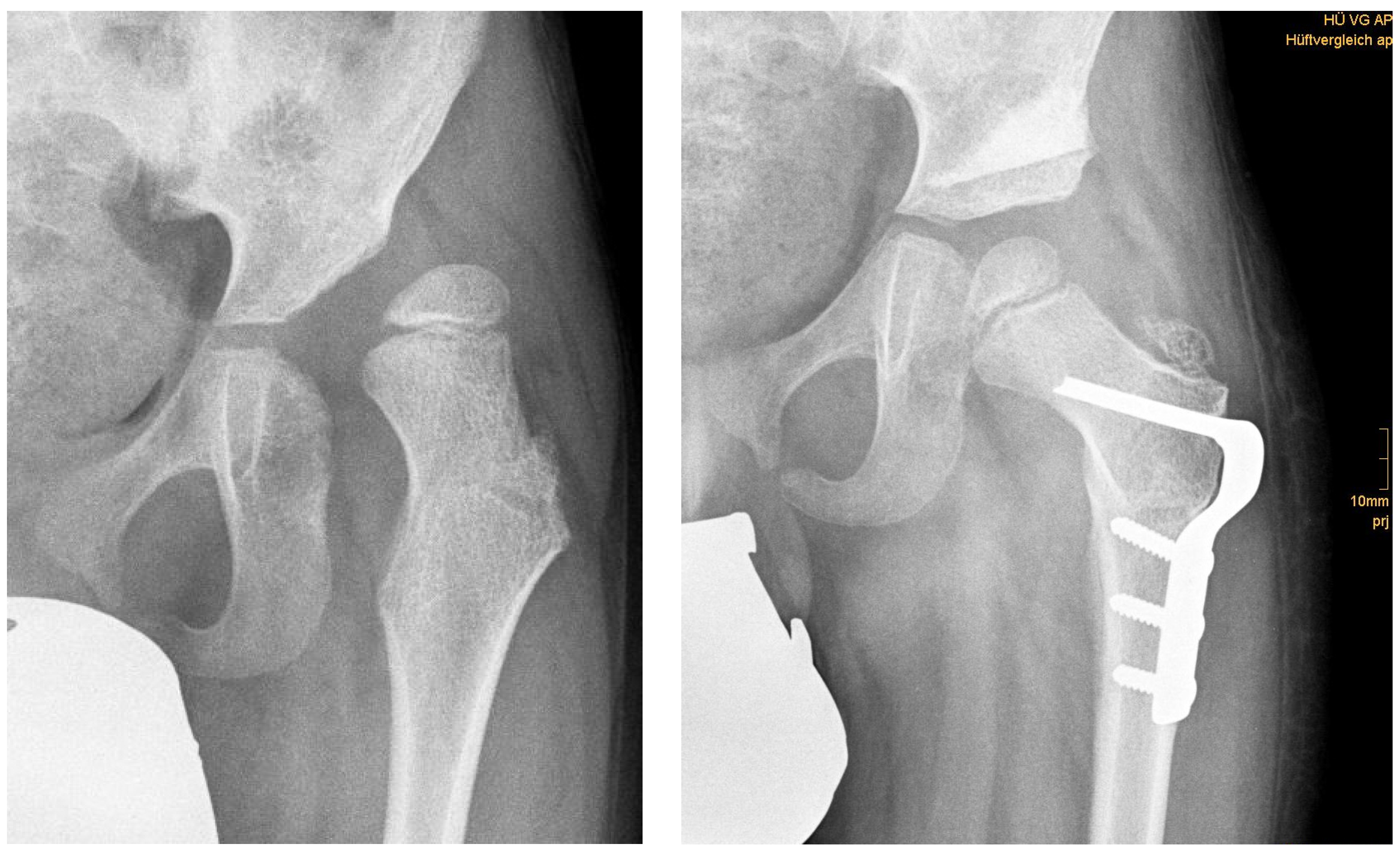 Children 09 00441 g001