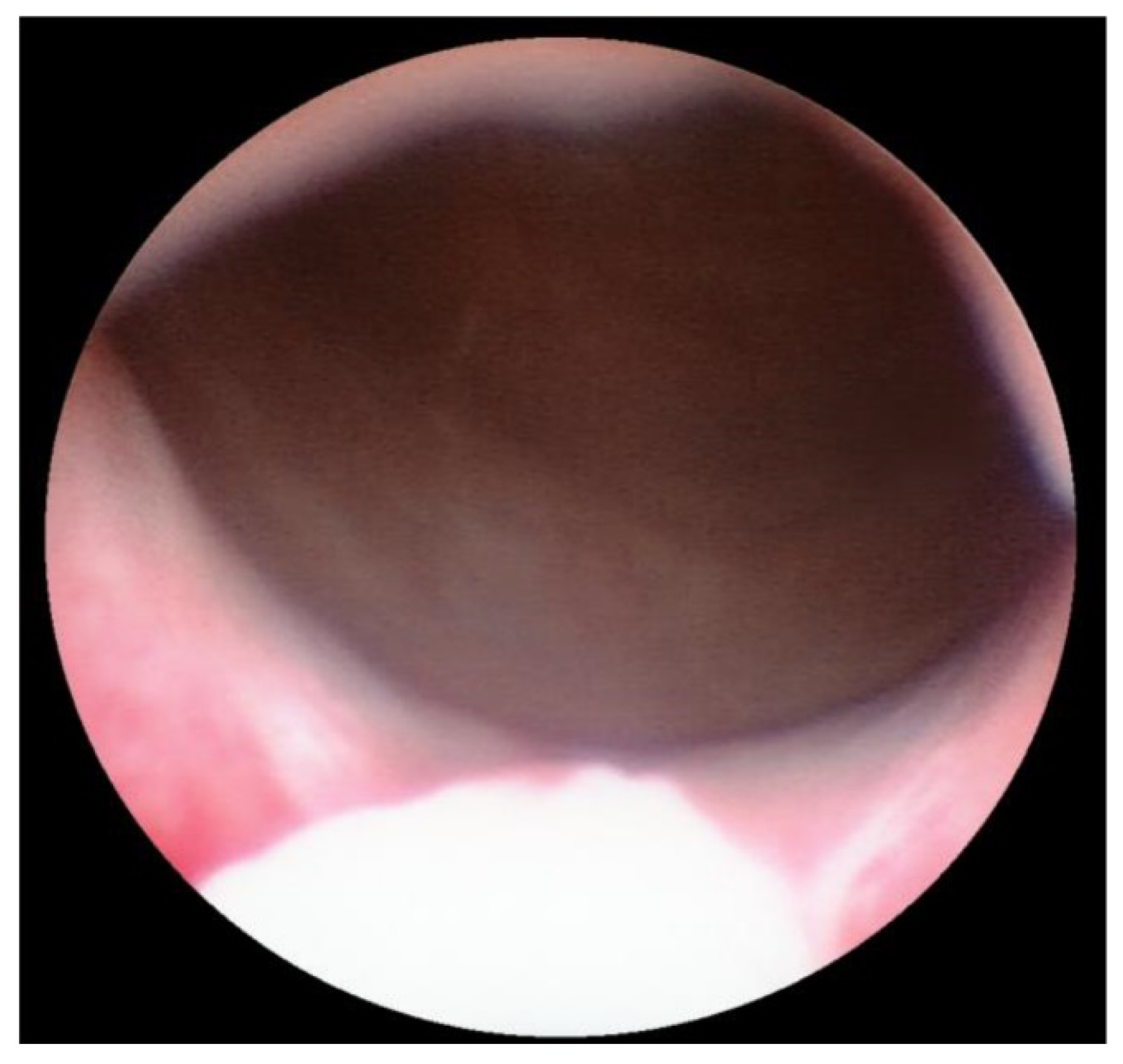 Children 09 00449 g005