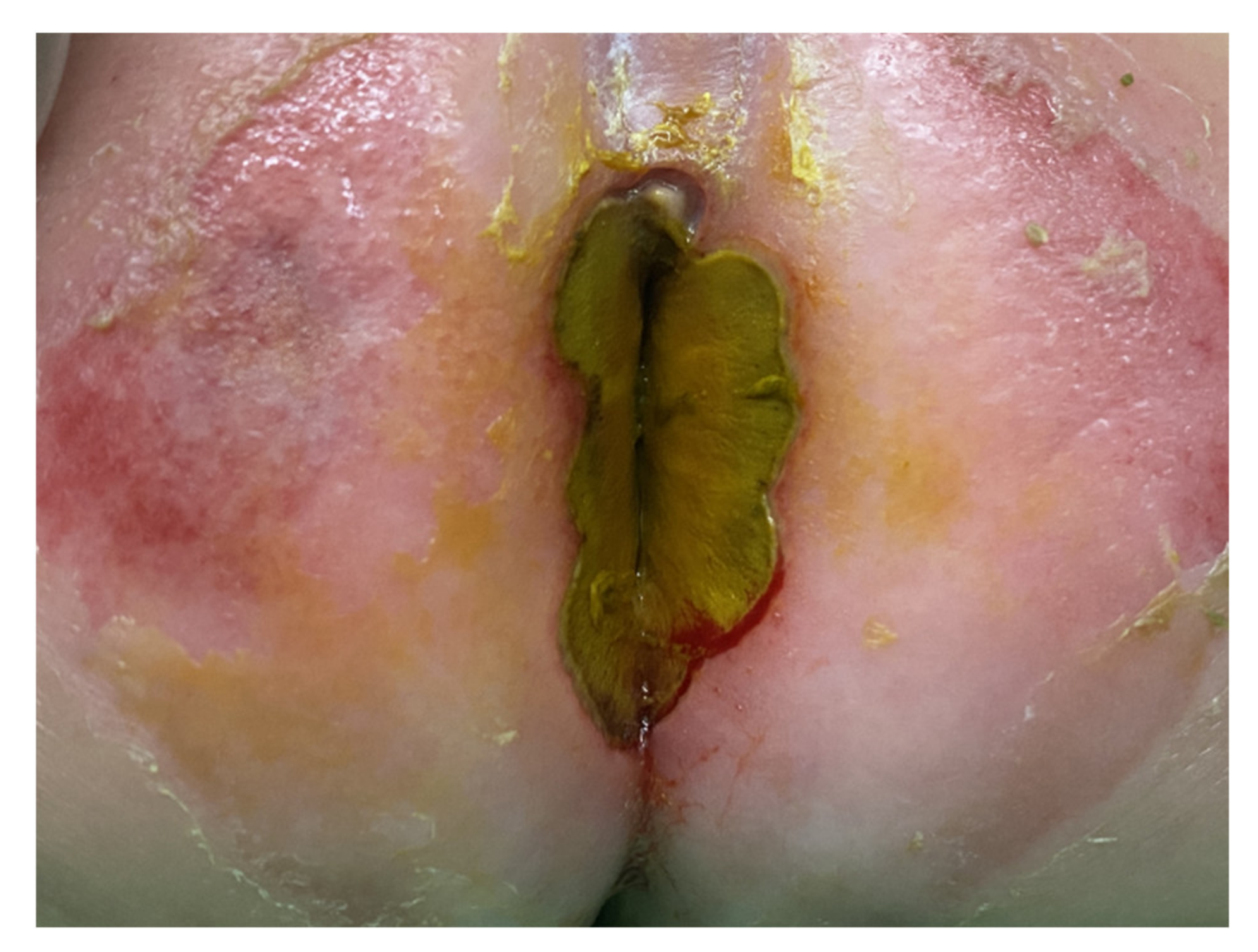 Children 09 00454 g001