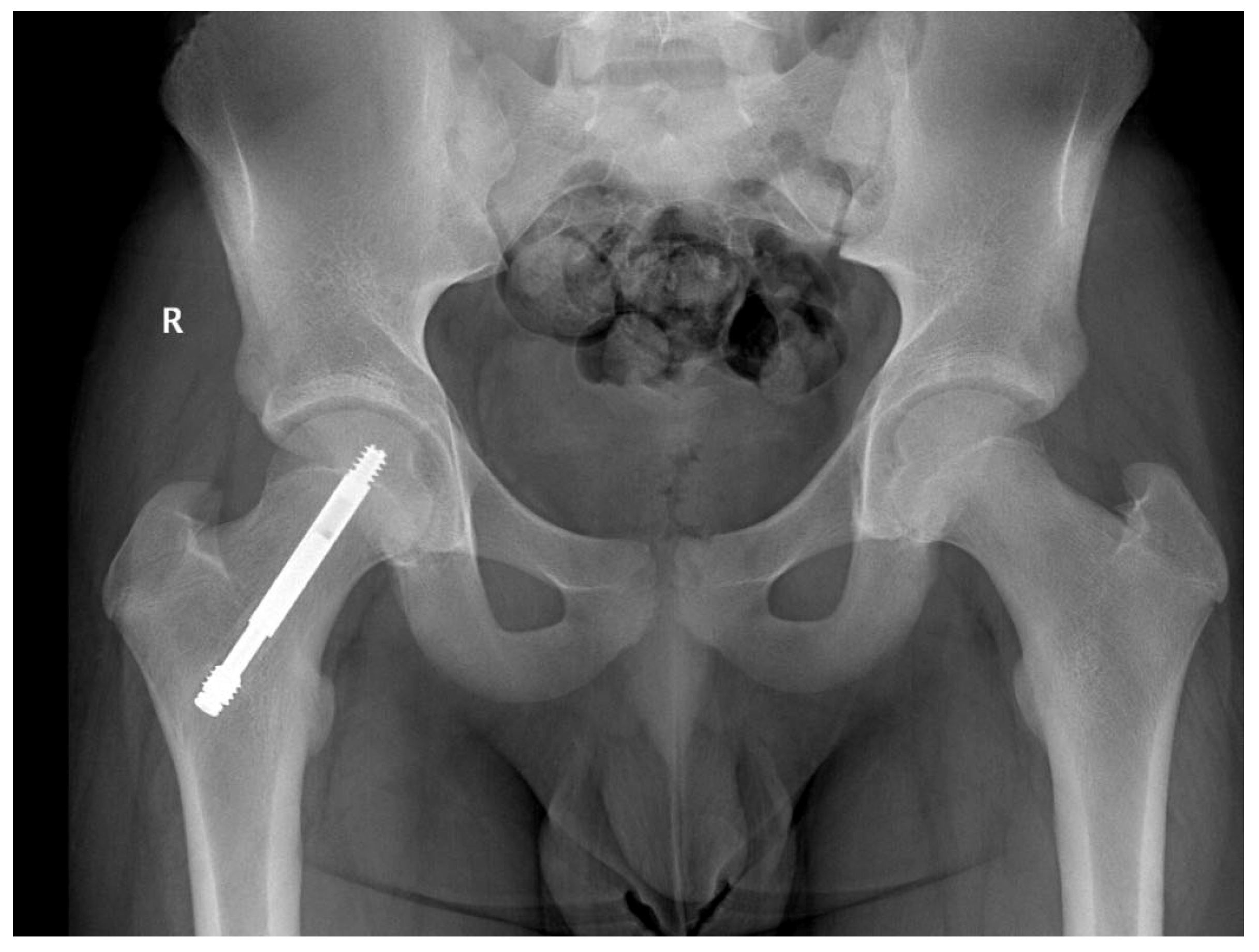 Children 09 00469 g003