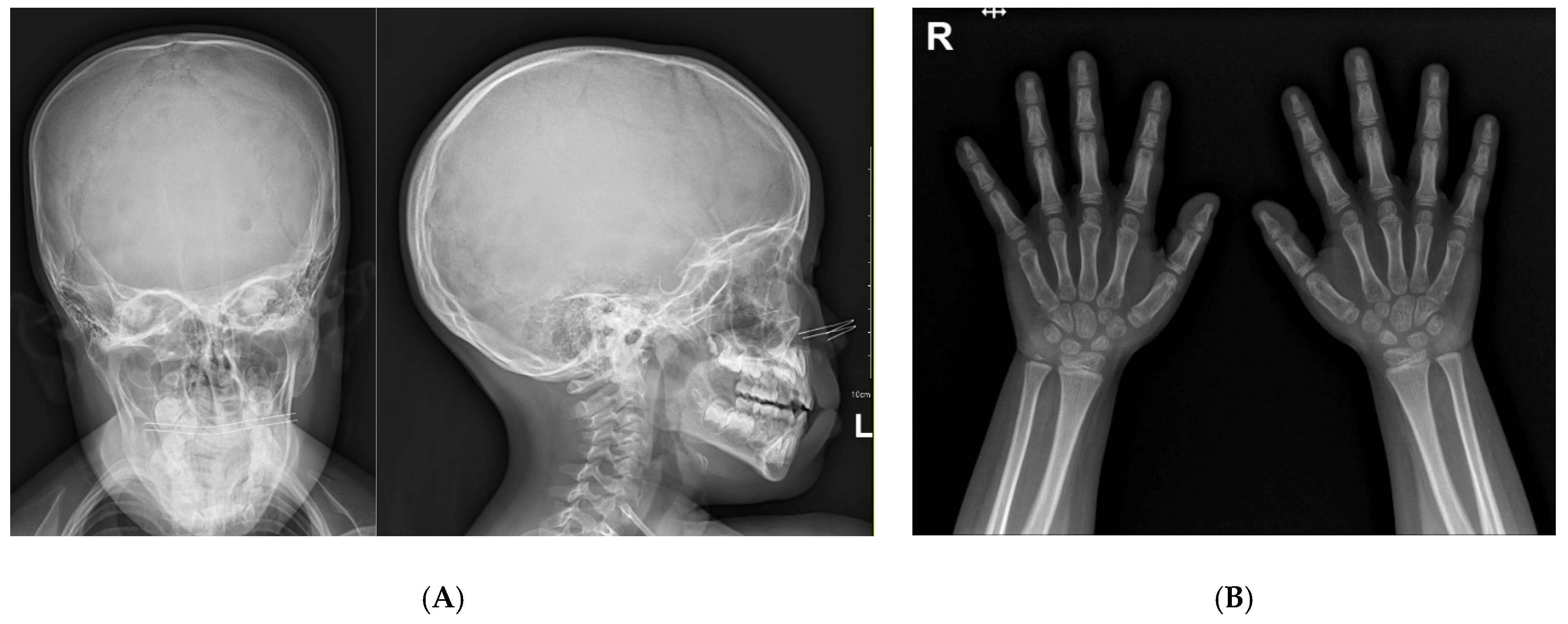 Children 09 00547 g002