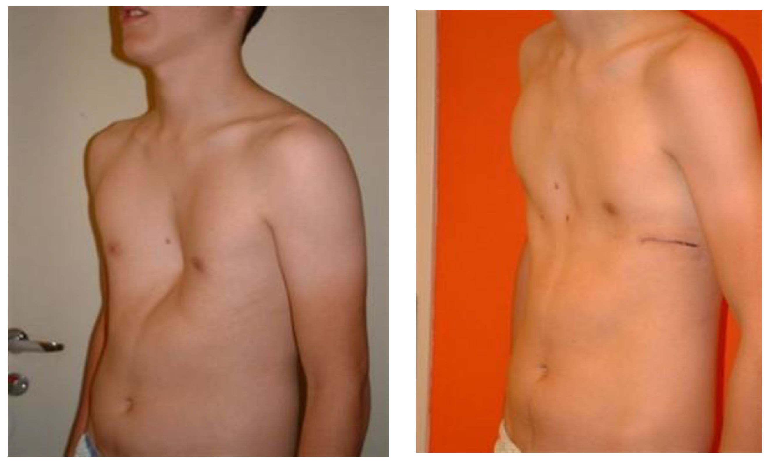 Children 09 00557 g002